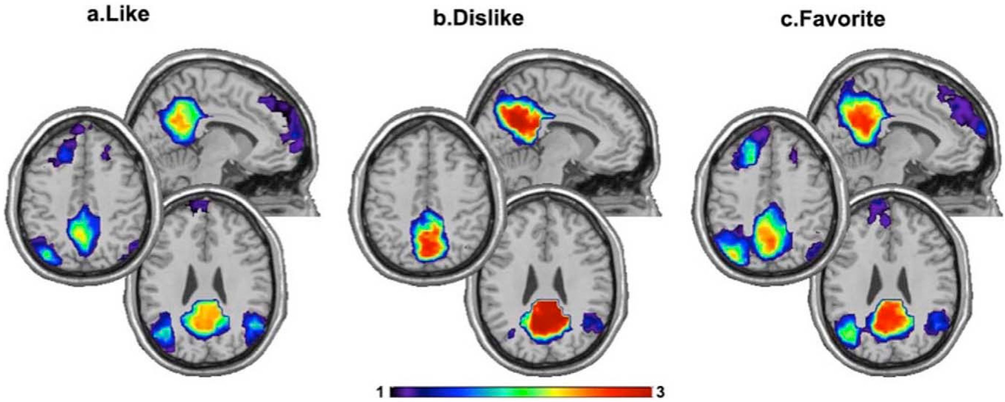 Music in the brain Nature Reviews Neuroscience