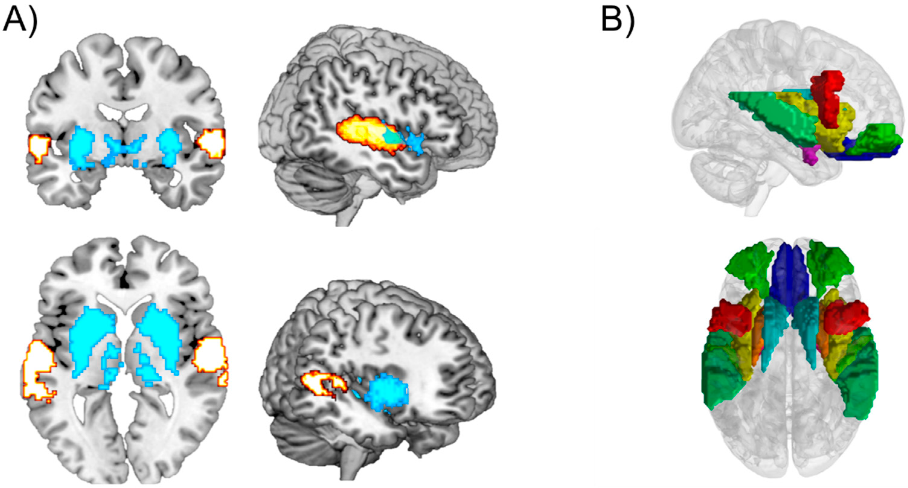 Brainsci 08 00107 g002