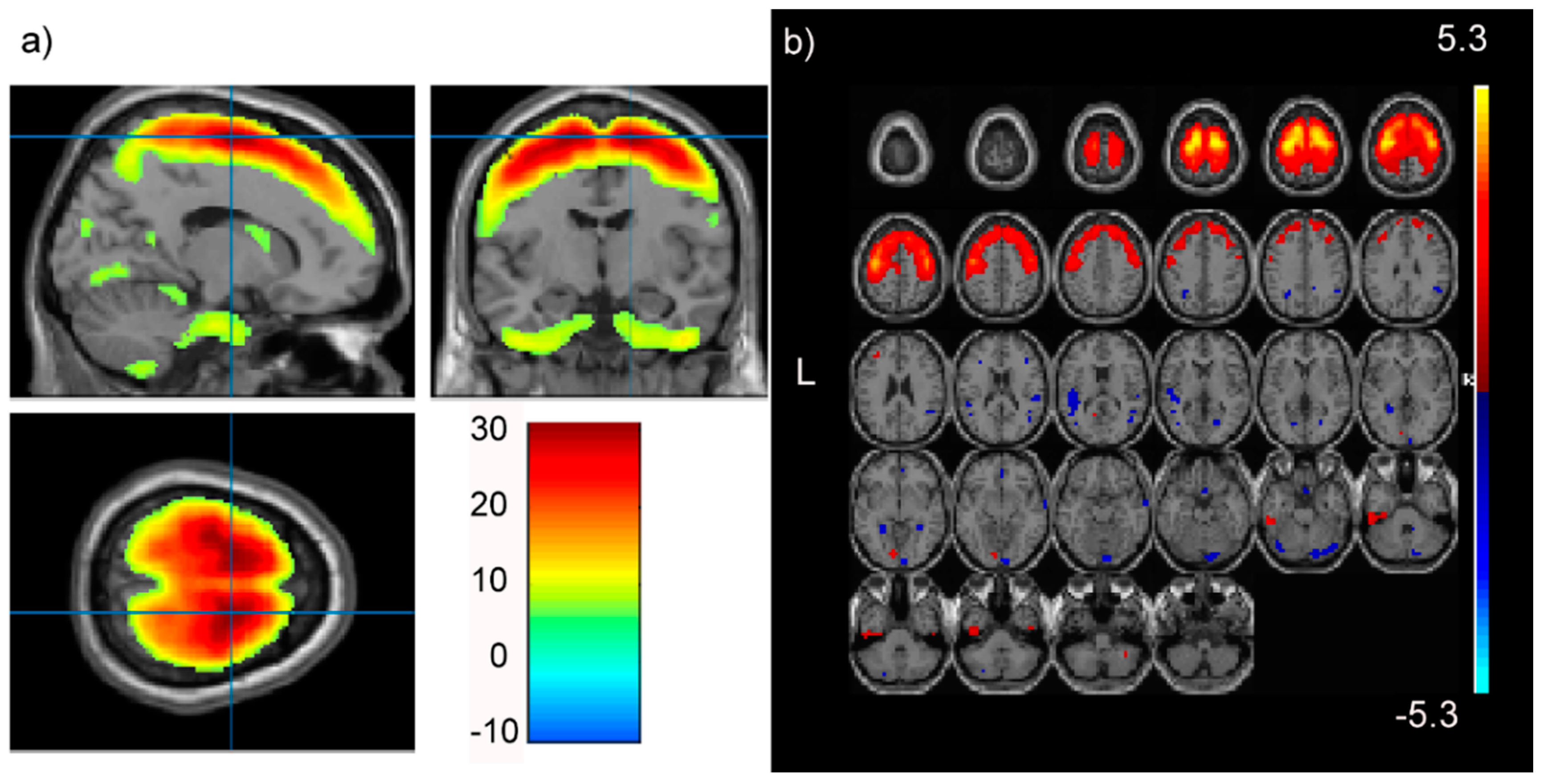 Brainsci 08 00116 g002