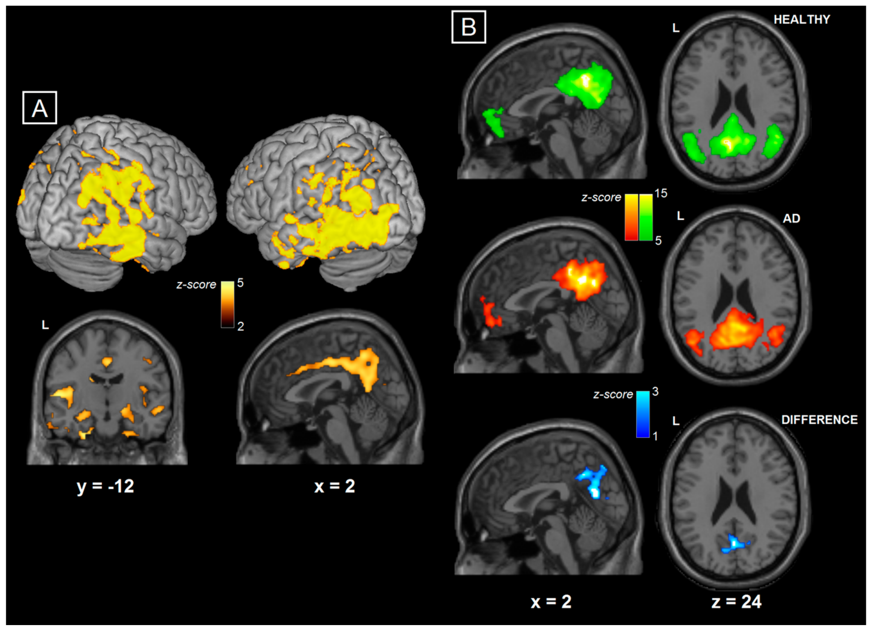 Brainsci 08 00134 g002 Brainsci 08 00134 g002