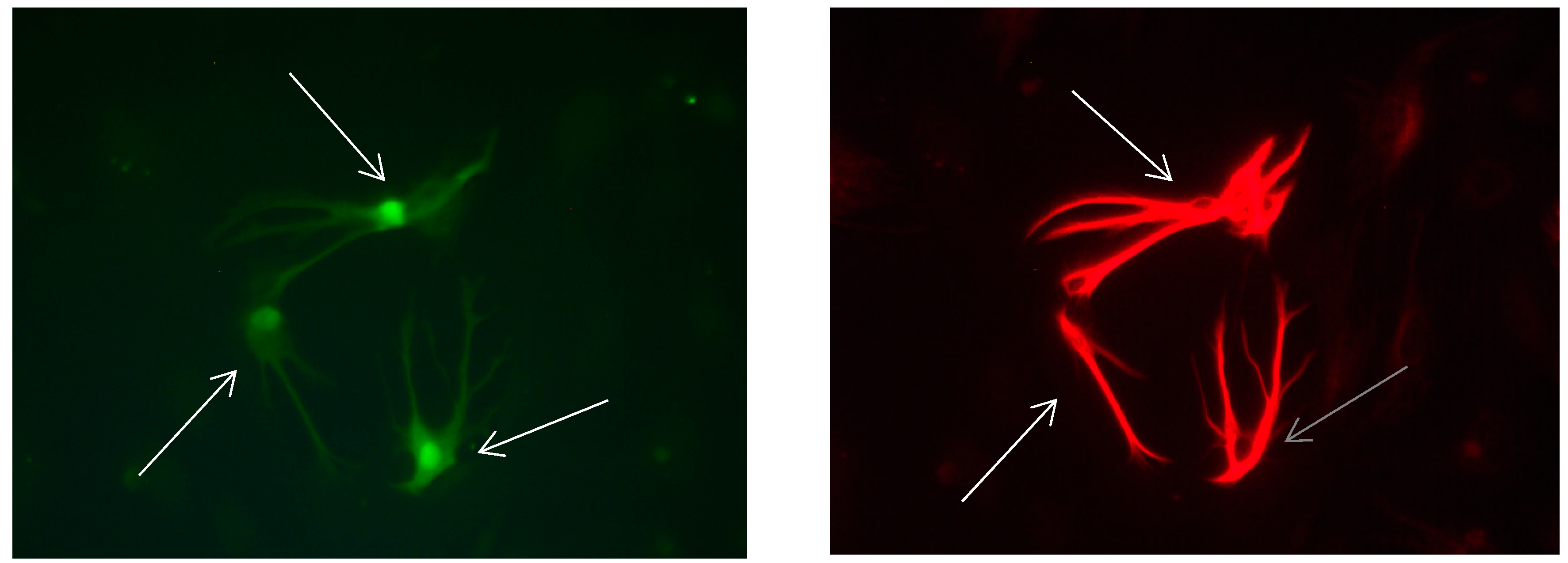 Brainsci 08 00143 g011