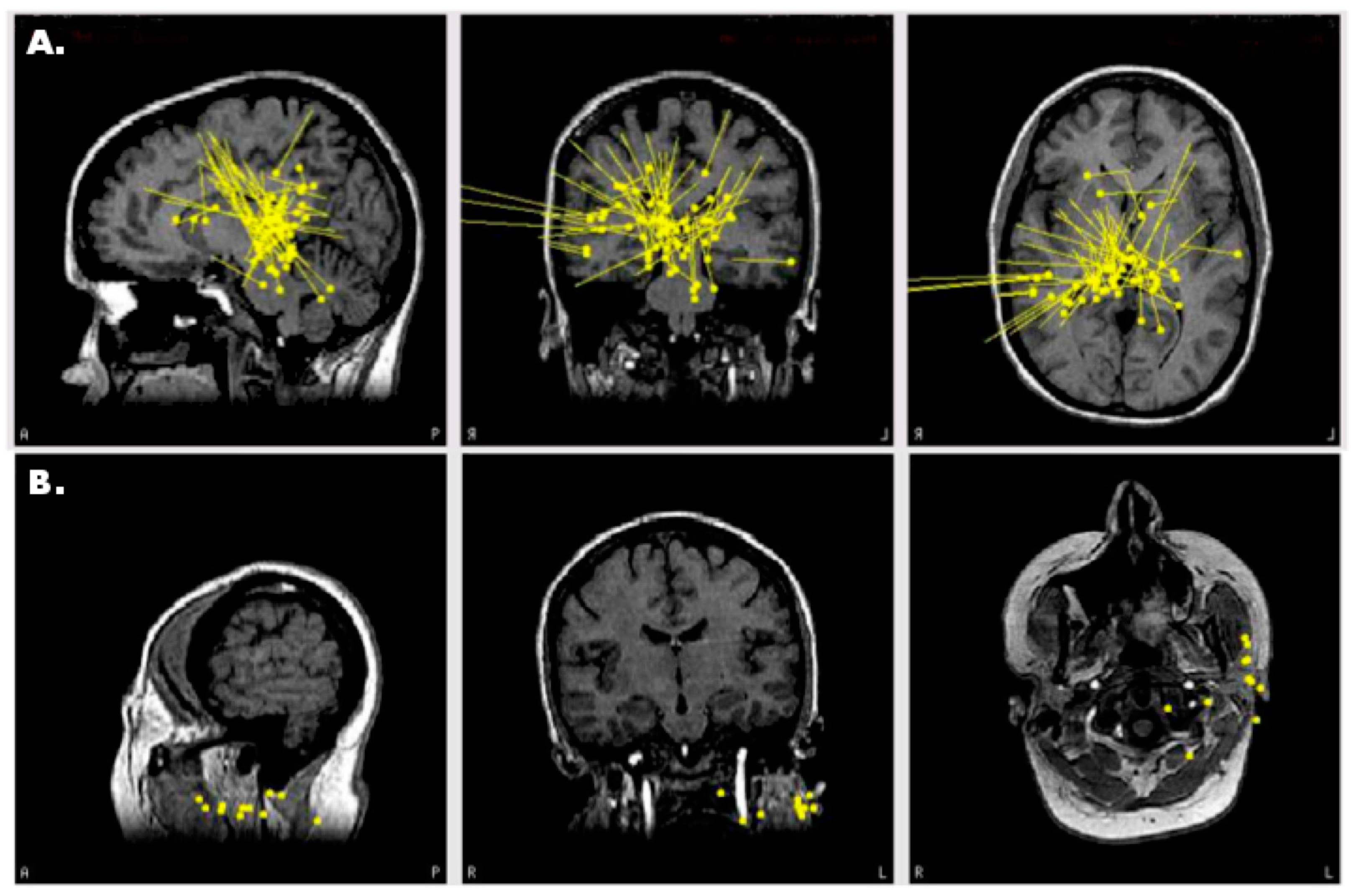 Brainsci 08 00157 g004
