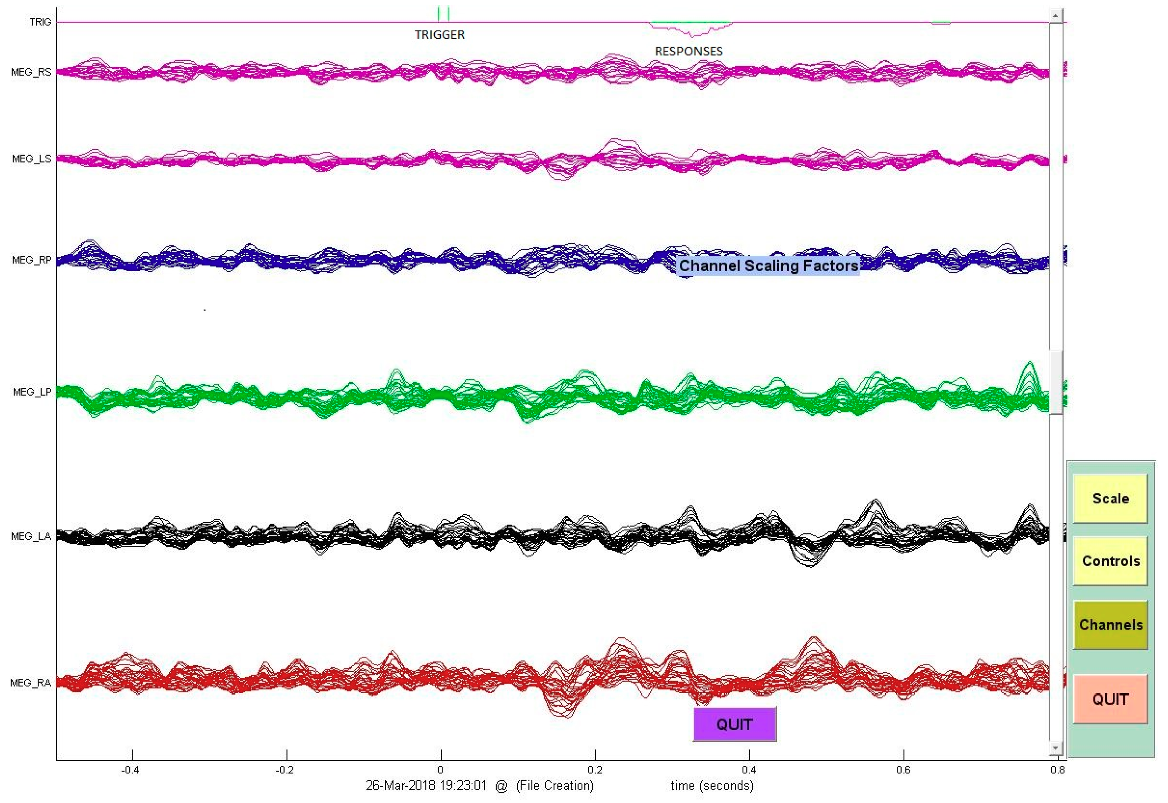 Brainsci 08 00159 g001