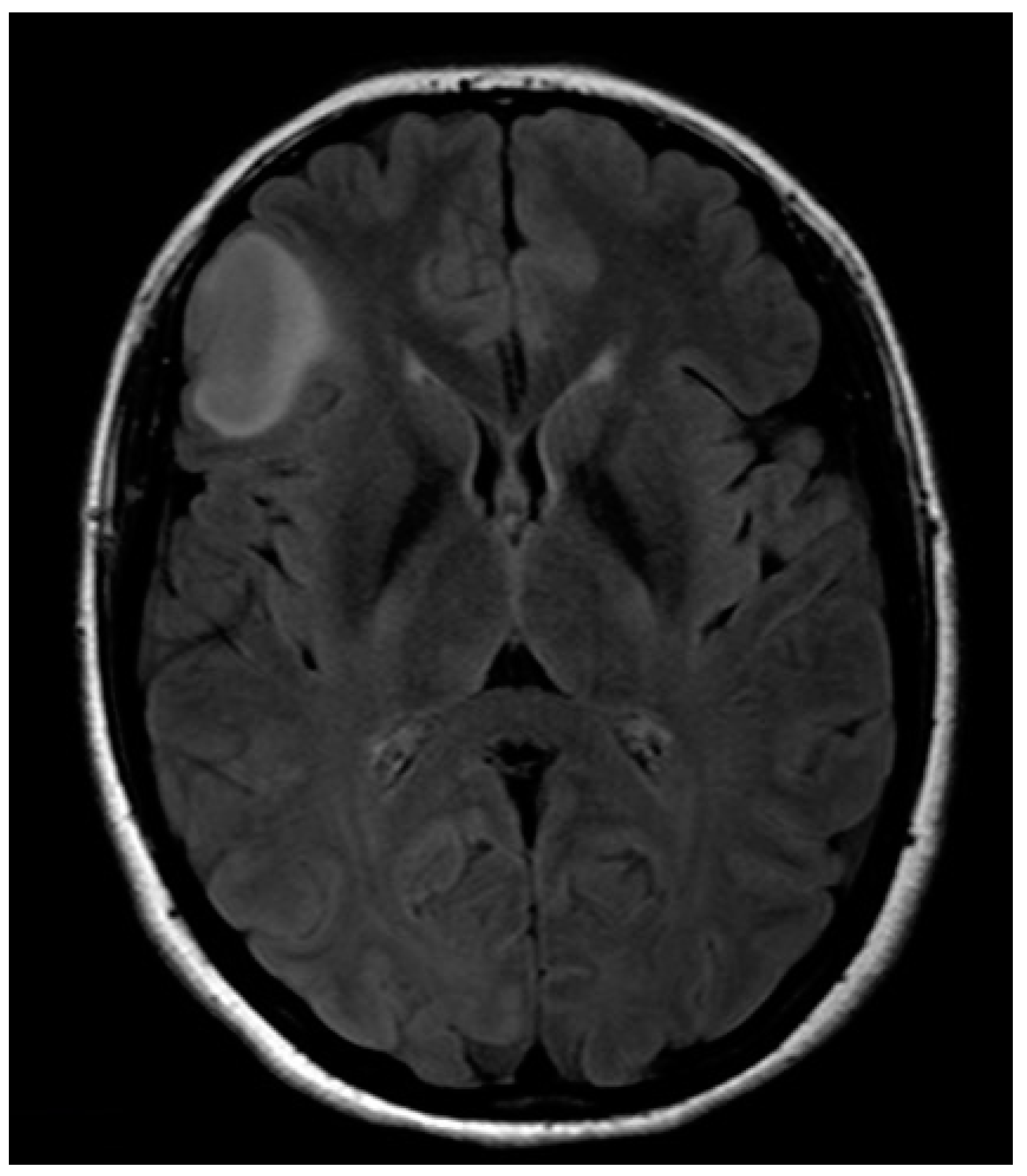Brainsci 08 00192 g001
