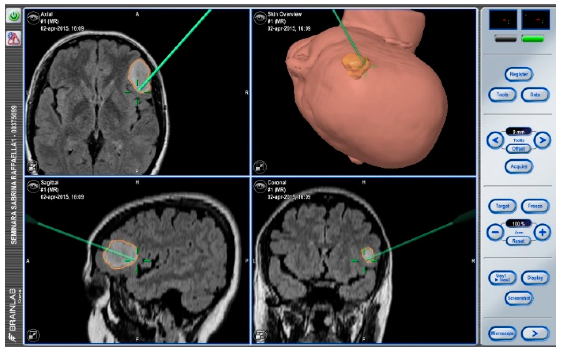 Brainsci 08 00192 g002