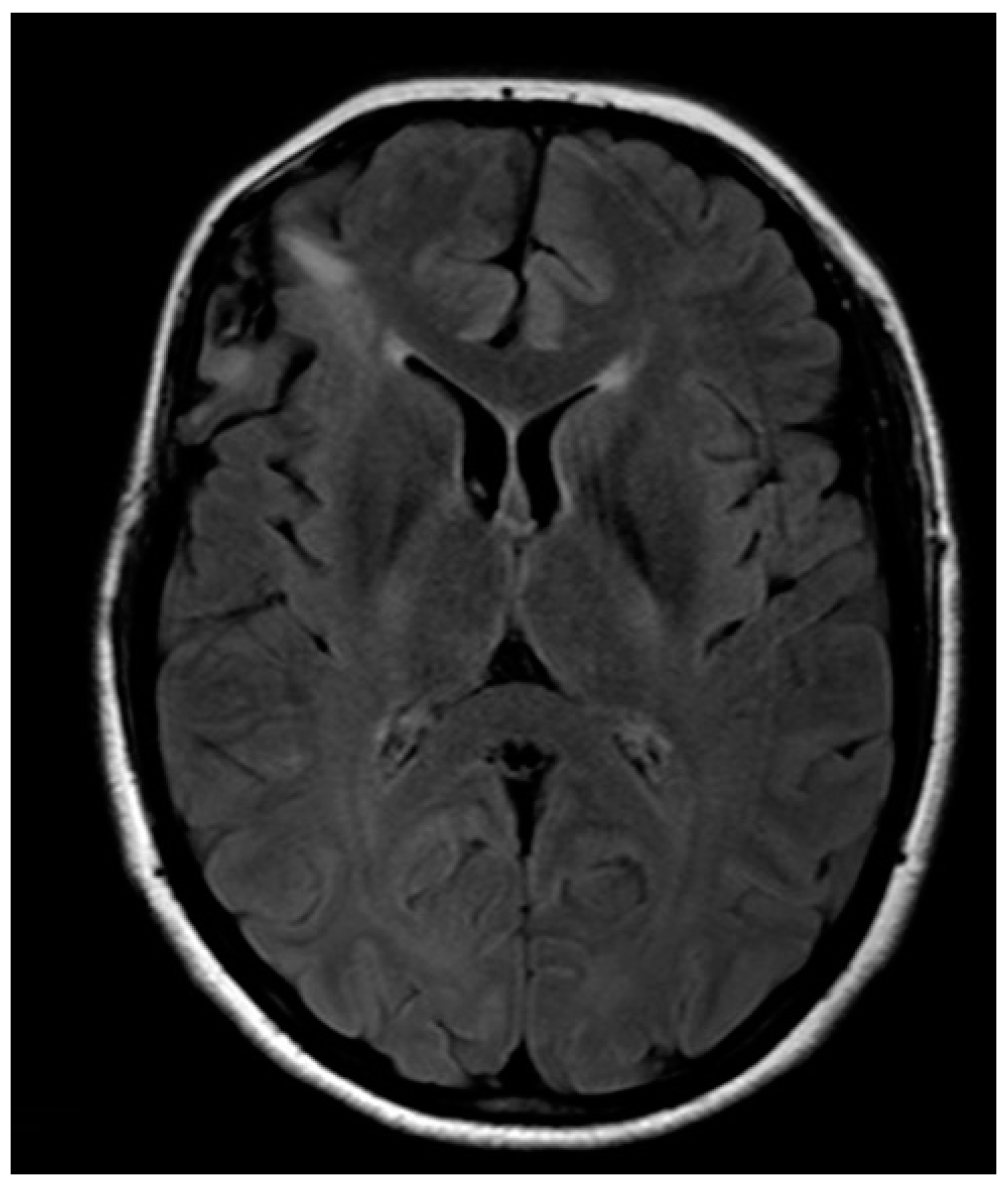 Brainsci 08 00192 g005