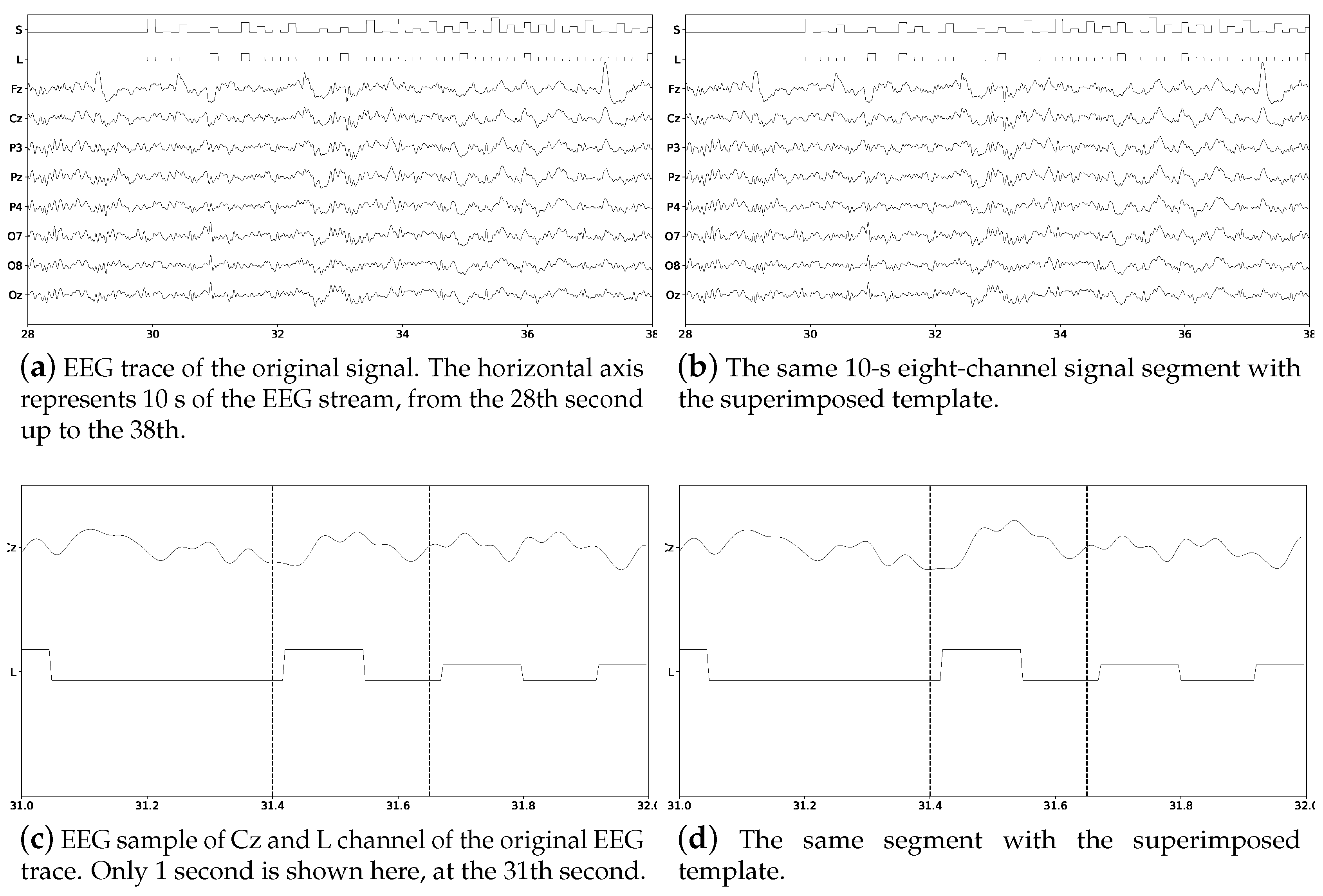 Brainsci 08 00199 g003 Brainsci 08 00199 g003