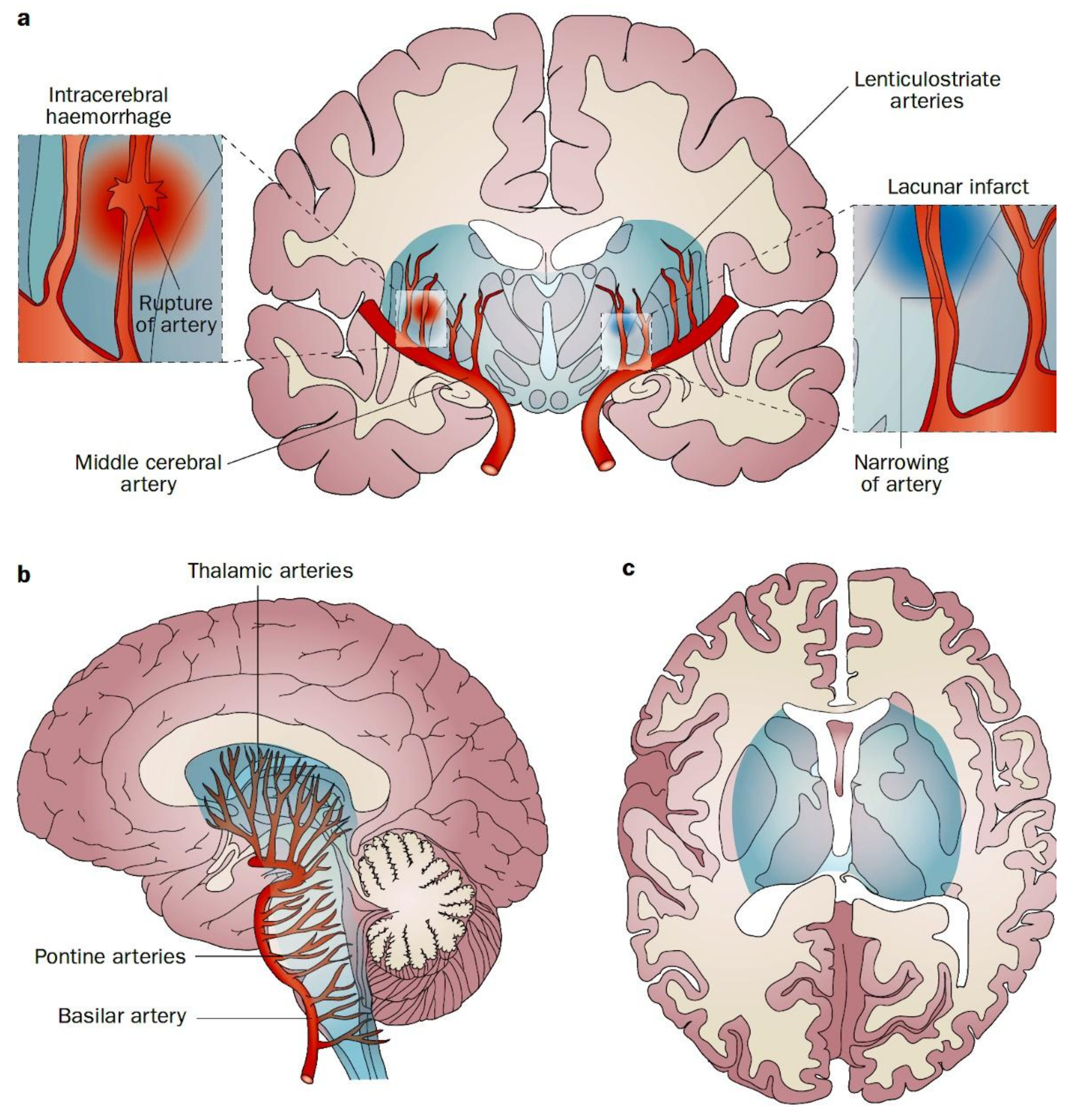 Brain Sciences | Free Full-Text | Blood Pressure Gradients in the Brain