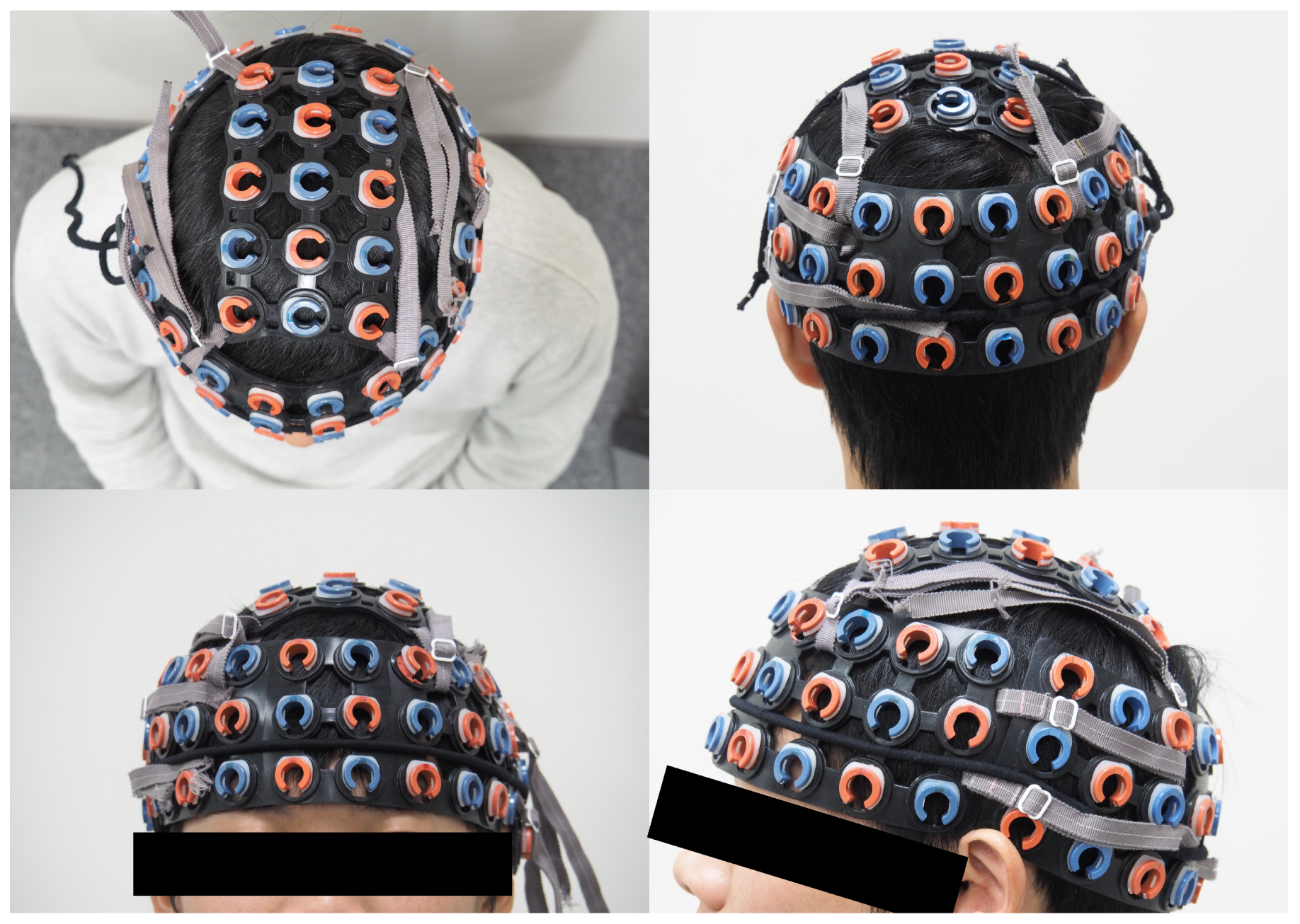 Brainsci 09 00043 g002 Brainsci 09 00043 g002