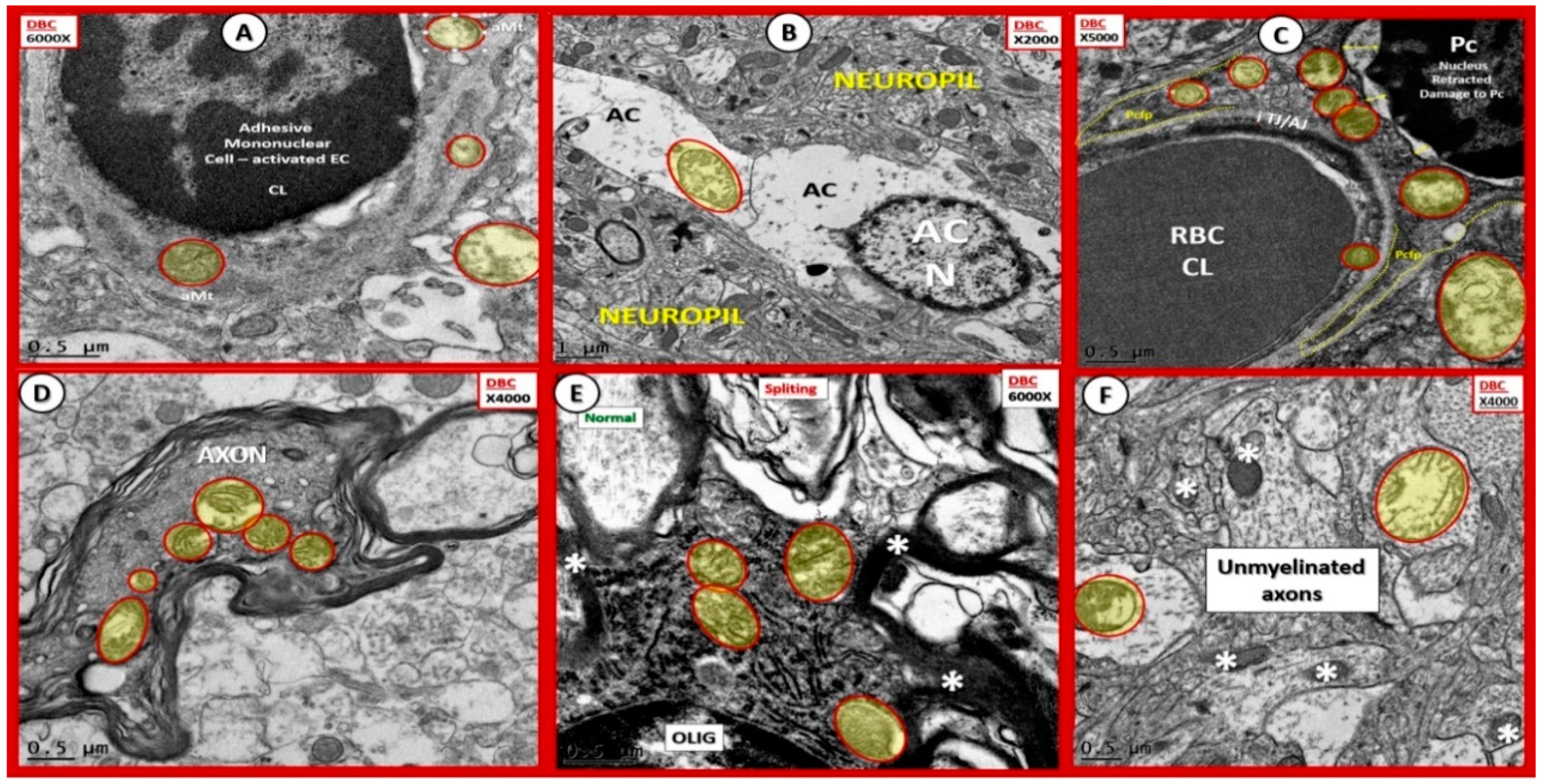 Brainsci 09 00057 g005