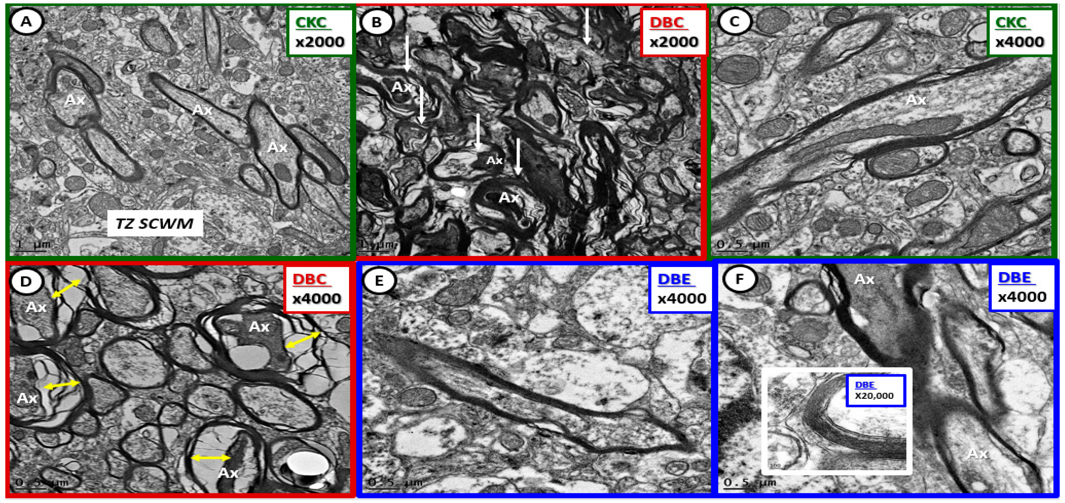 Brainsci 09 00057 g010