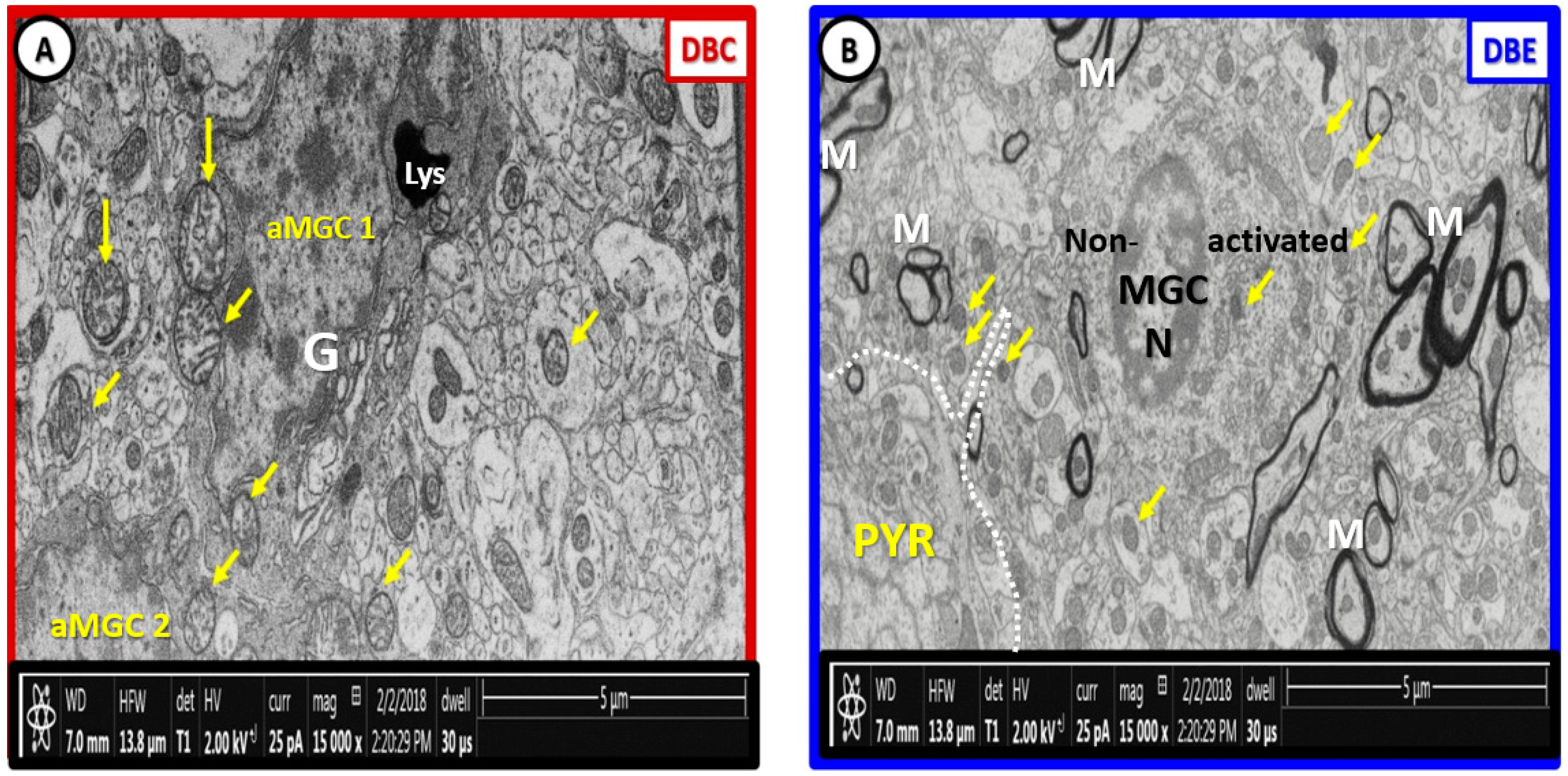 Brainsci 09 00057 g012