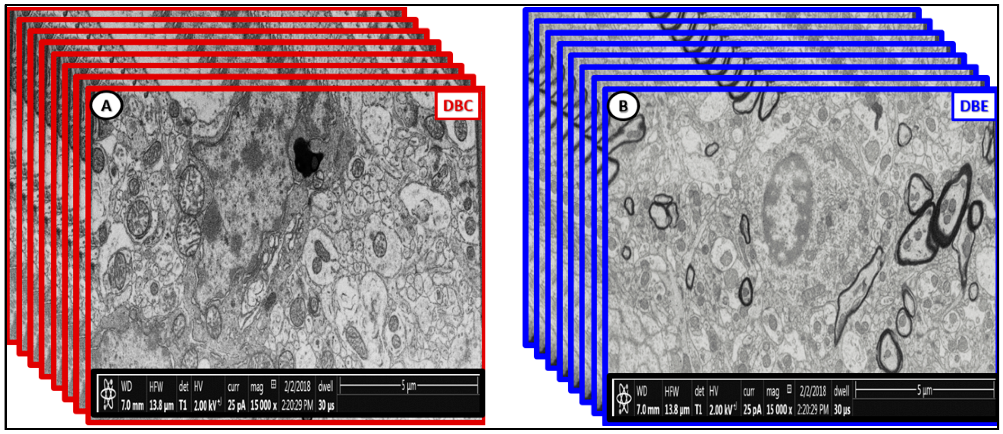 Brainsci 09 00057 g013