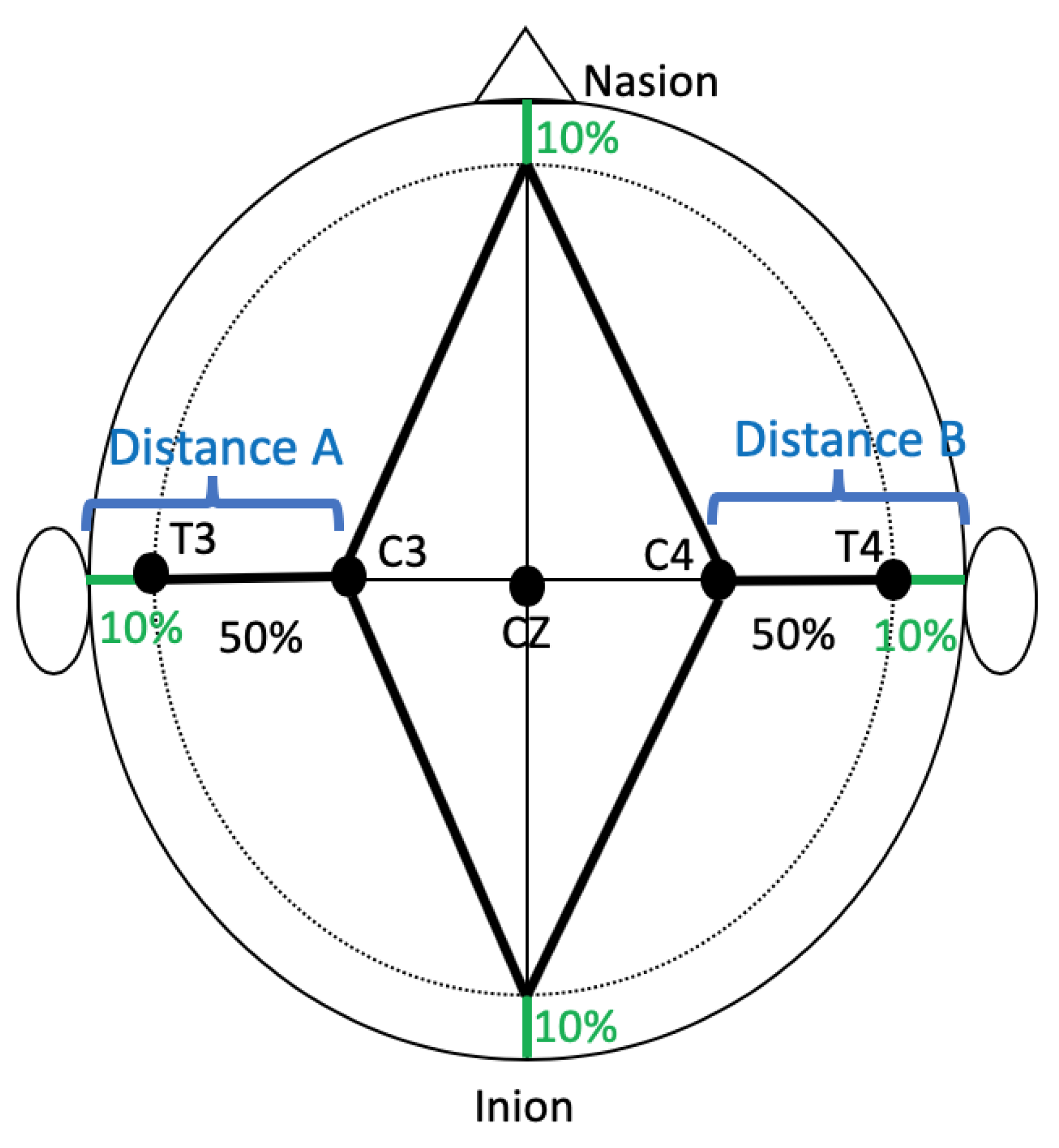 Eeg Placement Chart