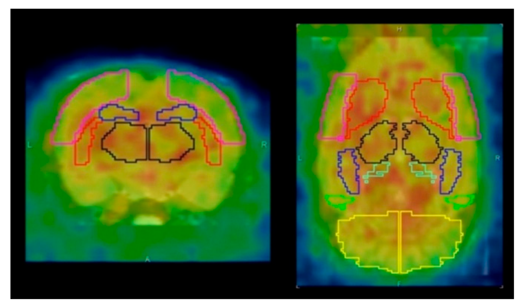 Brainsci 09 00101 g001 Brainsci 09 00101 g001