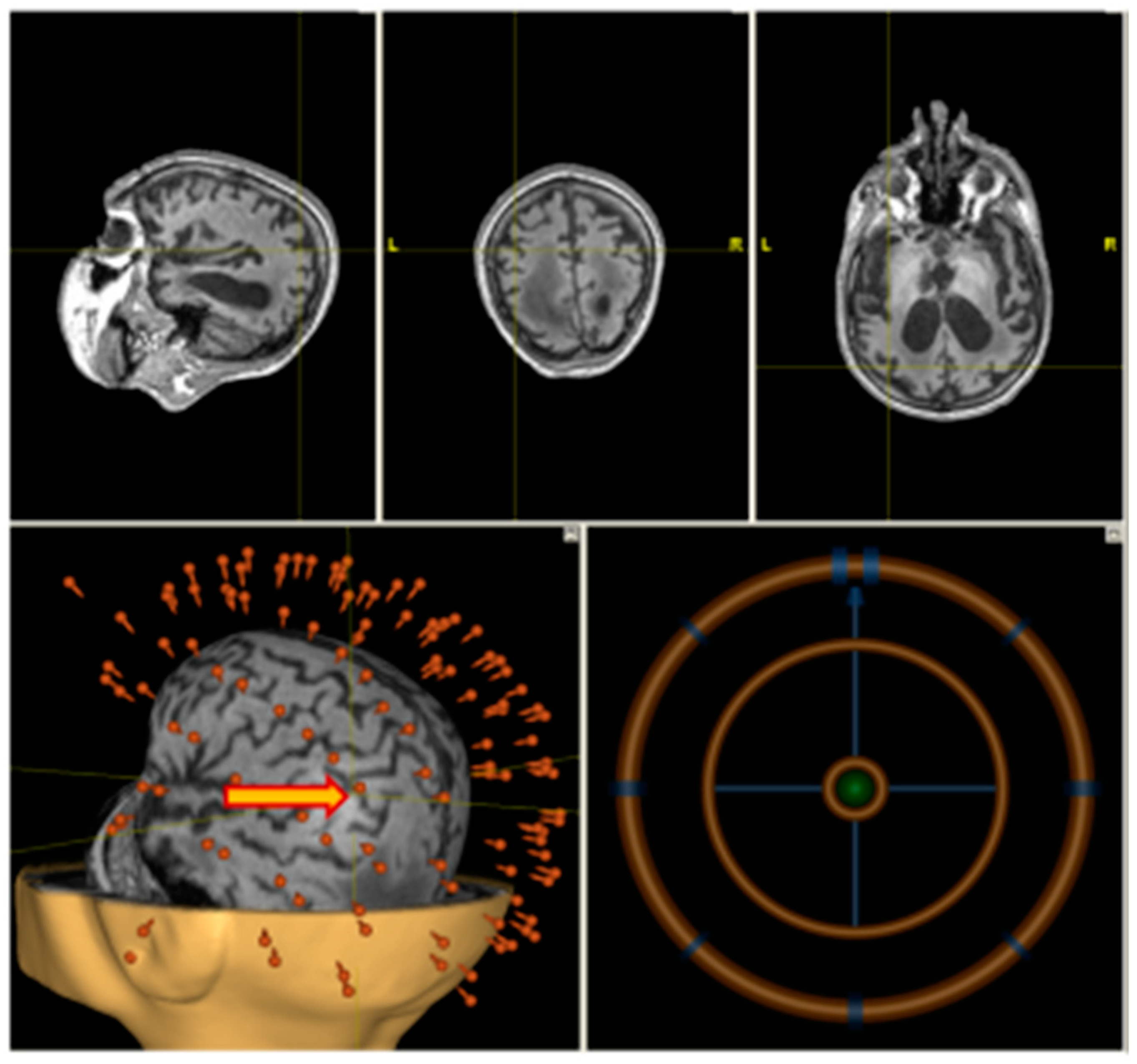Brainsci 09 00103 g002