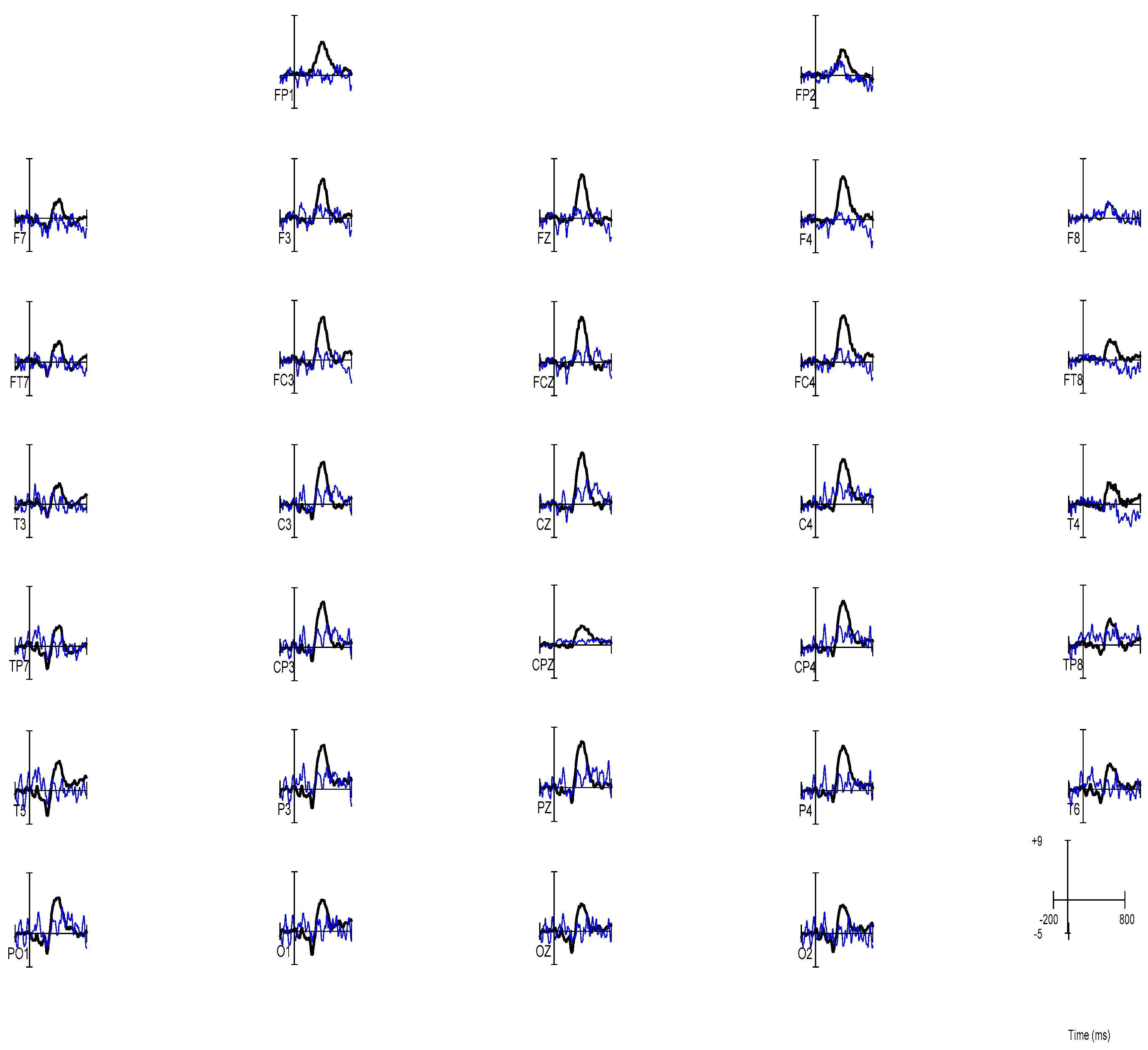 Brainsci 09 00109 g003 550