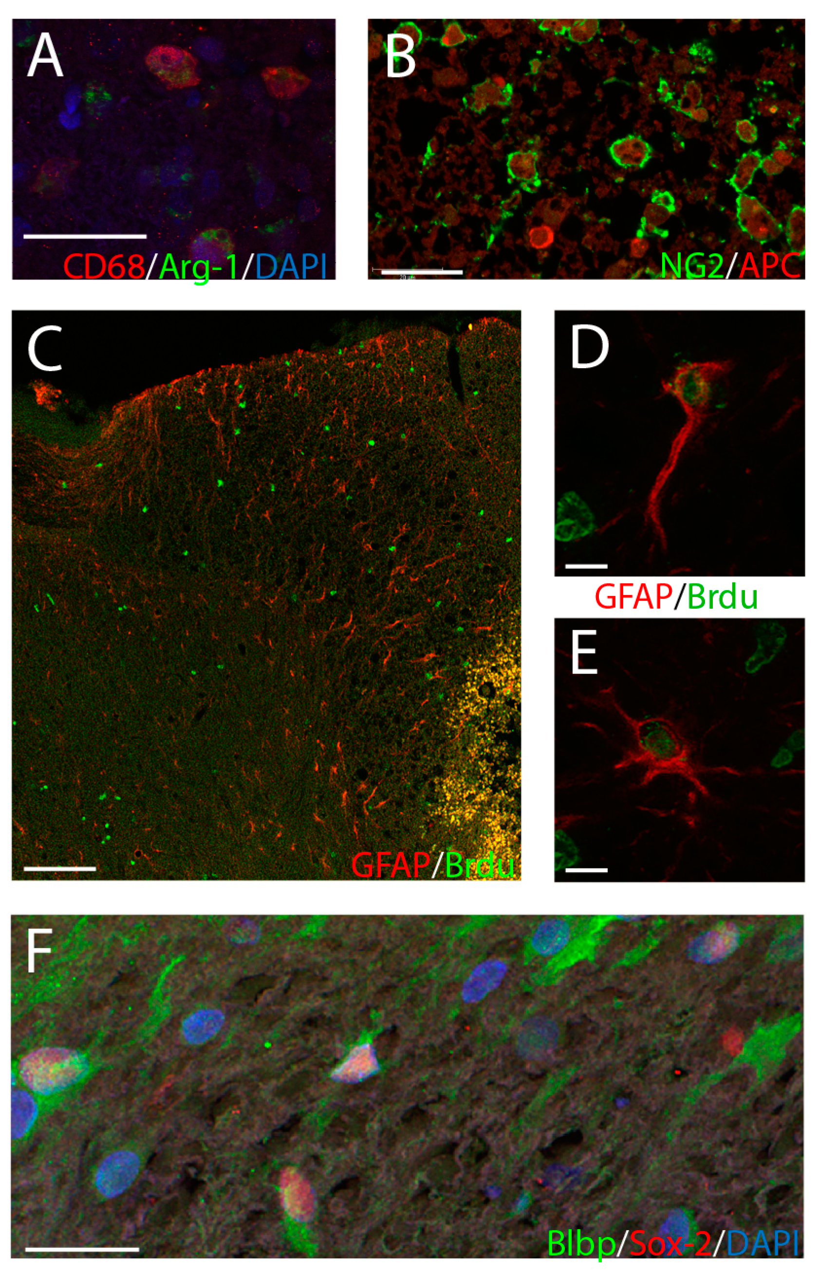 Brainsci 09 00124 g002