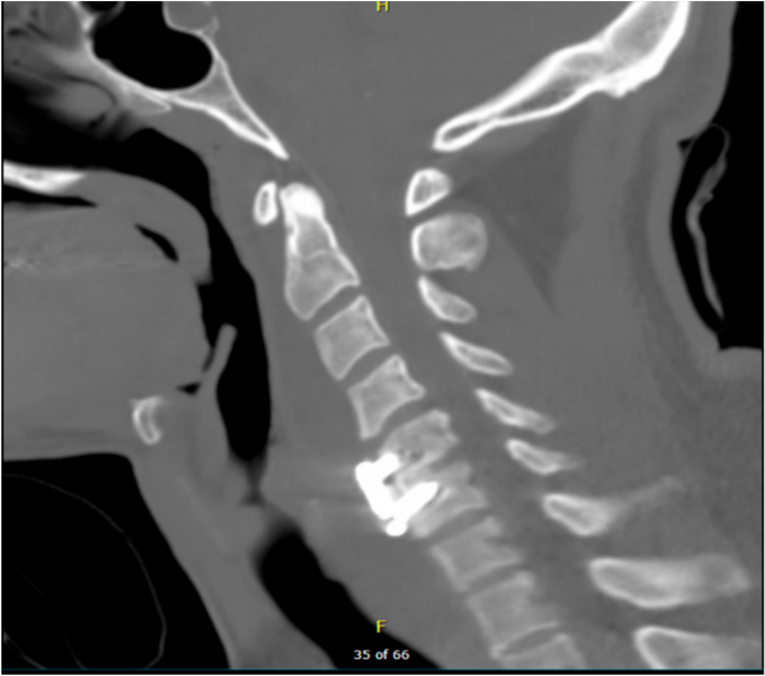 Brainsci 09 00125 g002 550