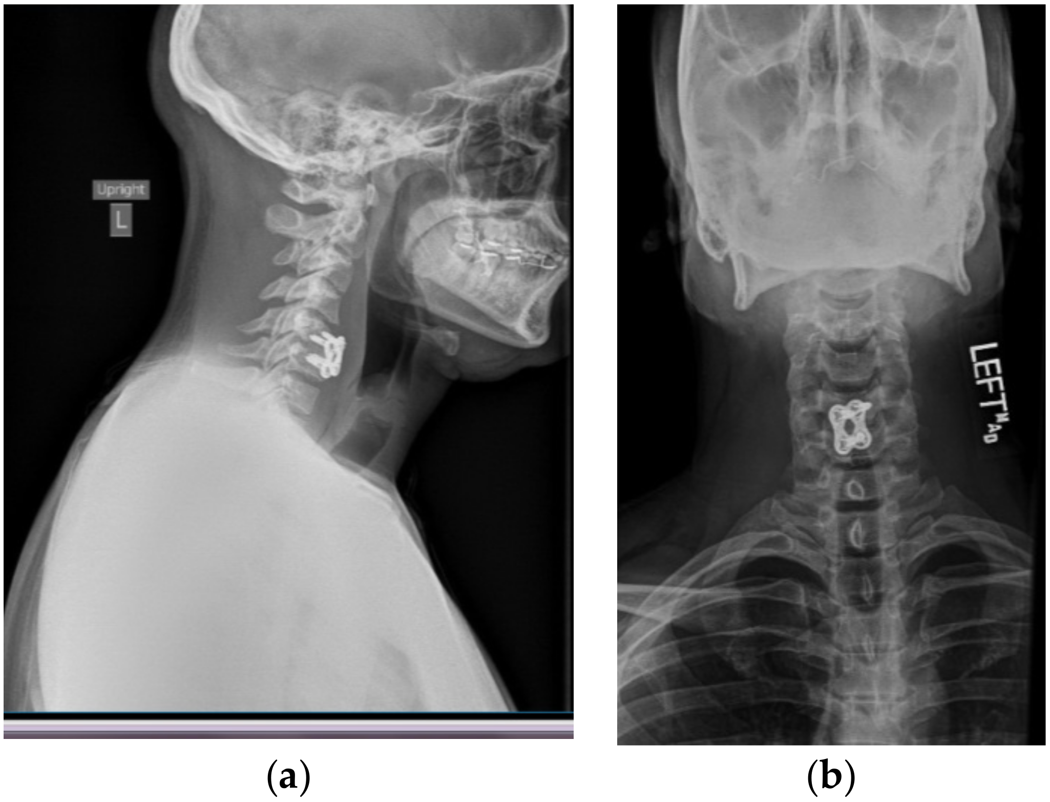 Brain Sciences | Free Full-Text | Self Manipulated Cervical Spine Leads