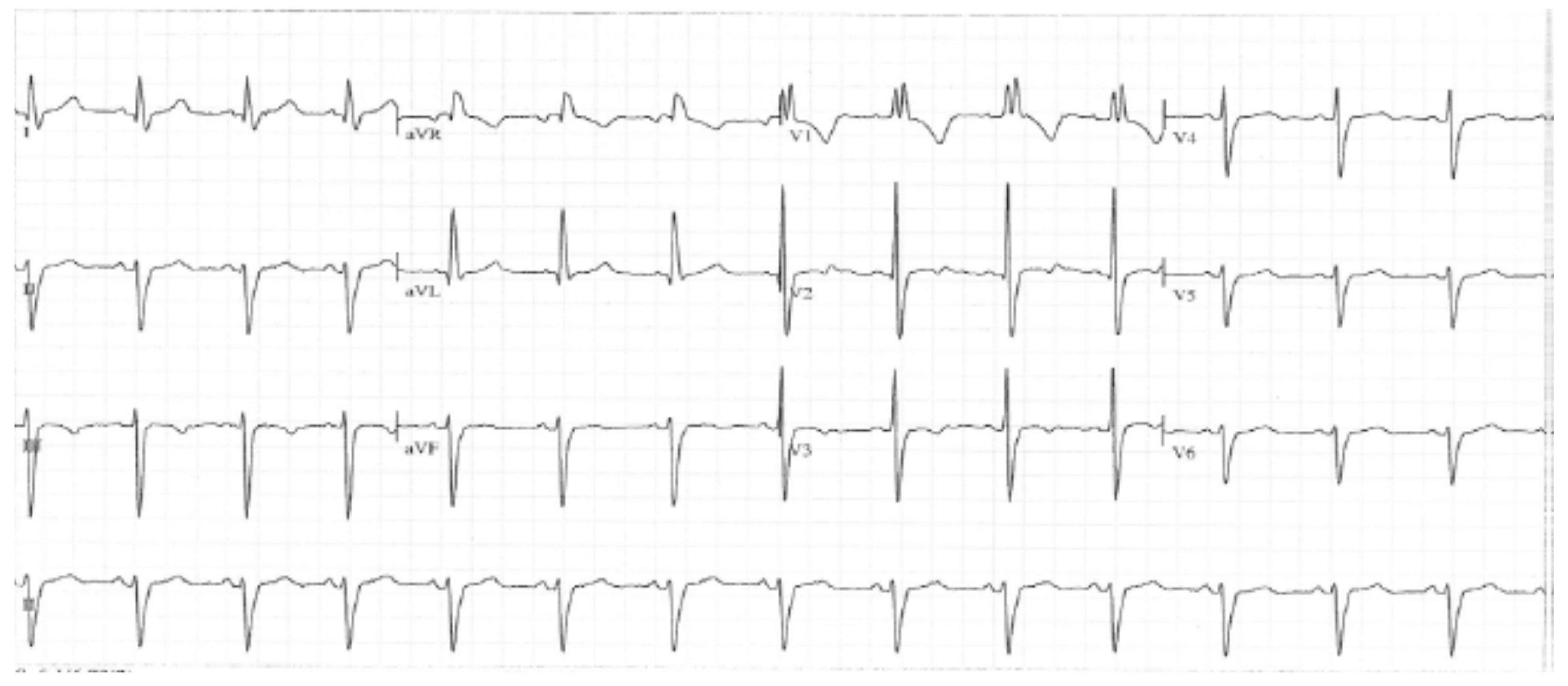 Brainsci 09 00137 g001 Brainsci 09 00137 g001