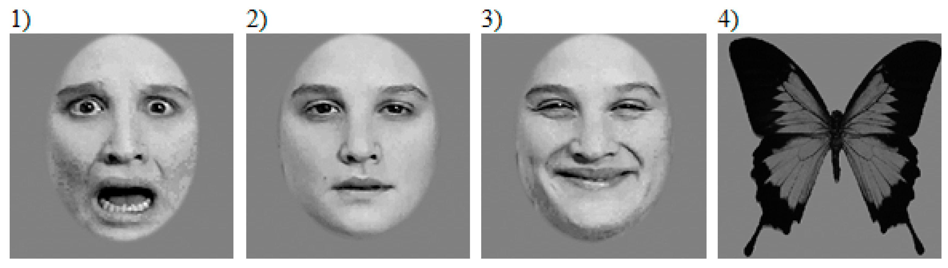 Brainsci 09 00142 g001 Brainsci 09 00142 g001