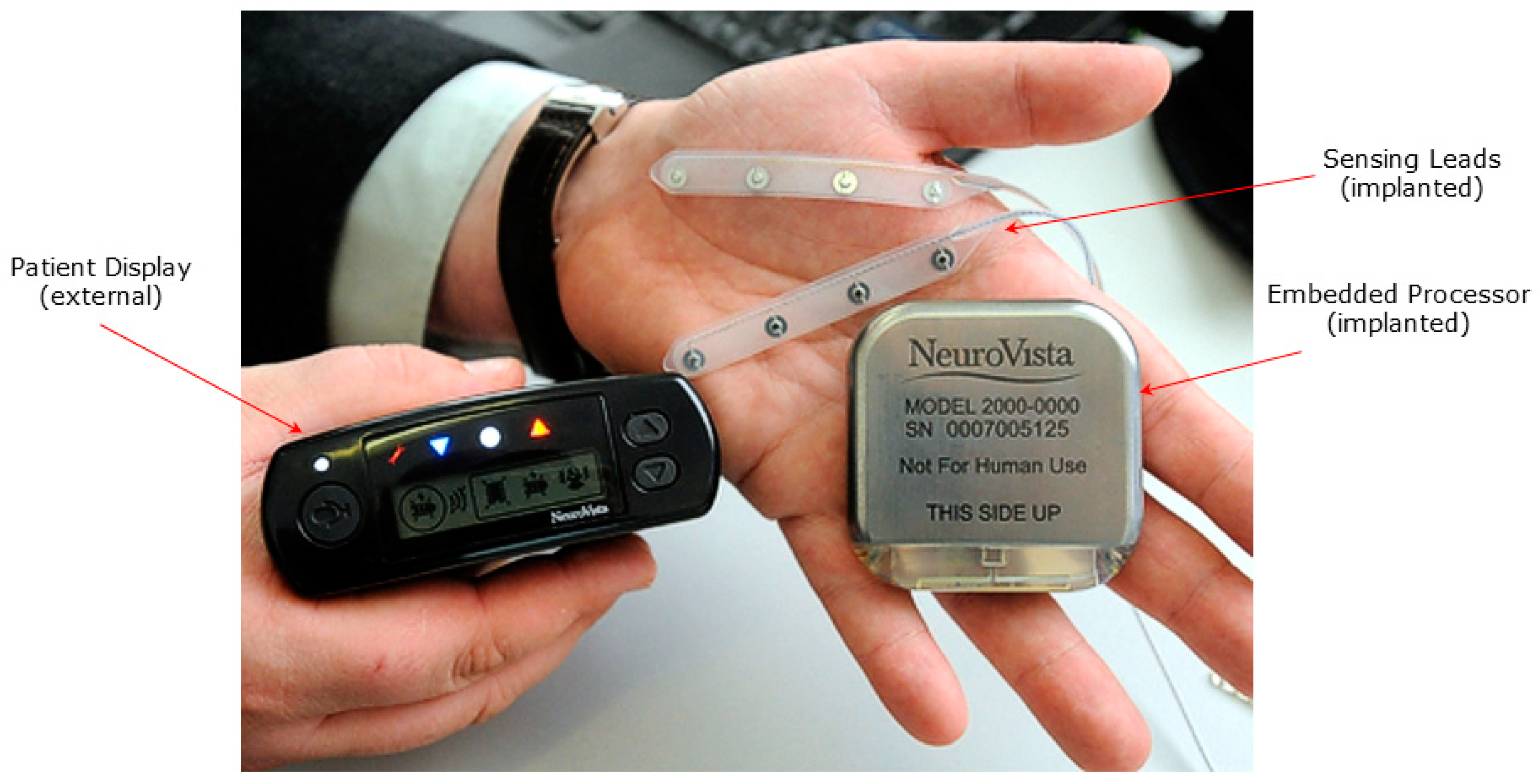 Brainsci 09 00156 g002 Brainsci 09 00156 g002