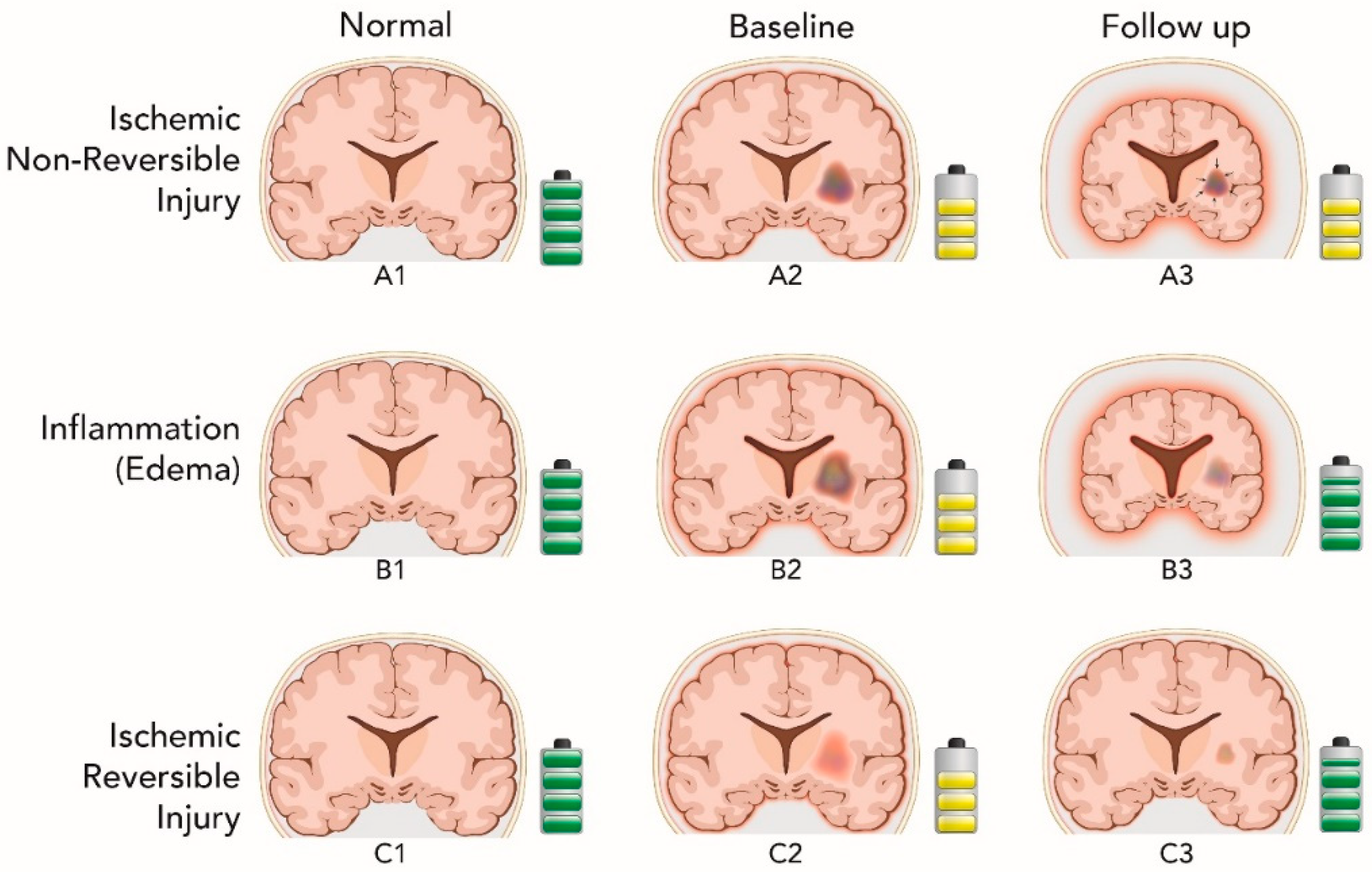 Brainsci 09 00170 g003