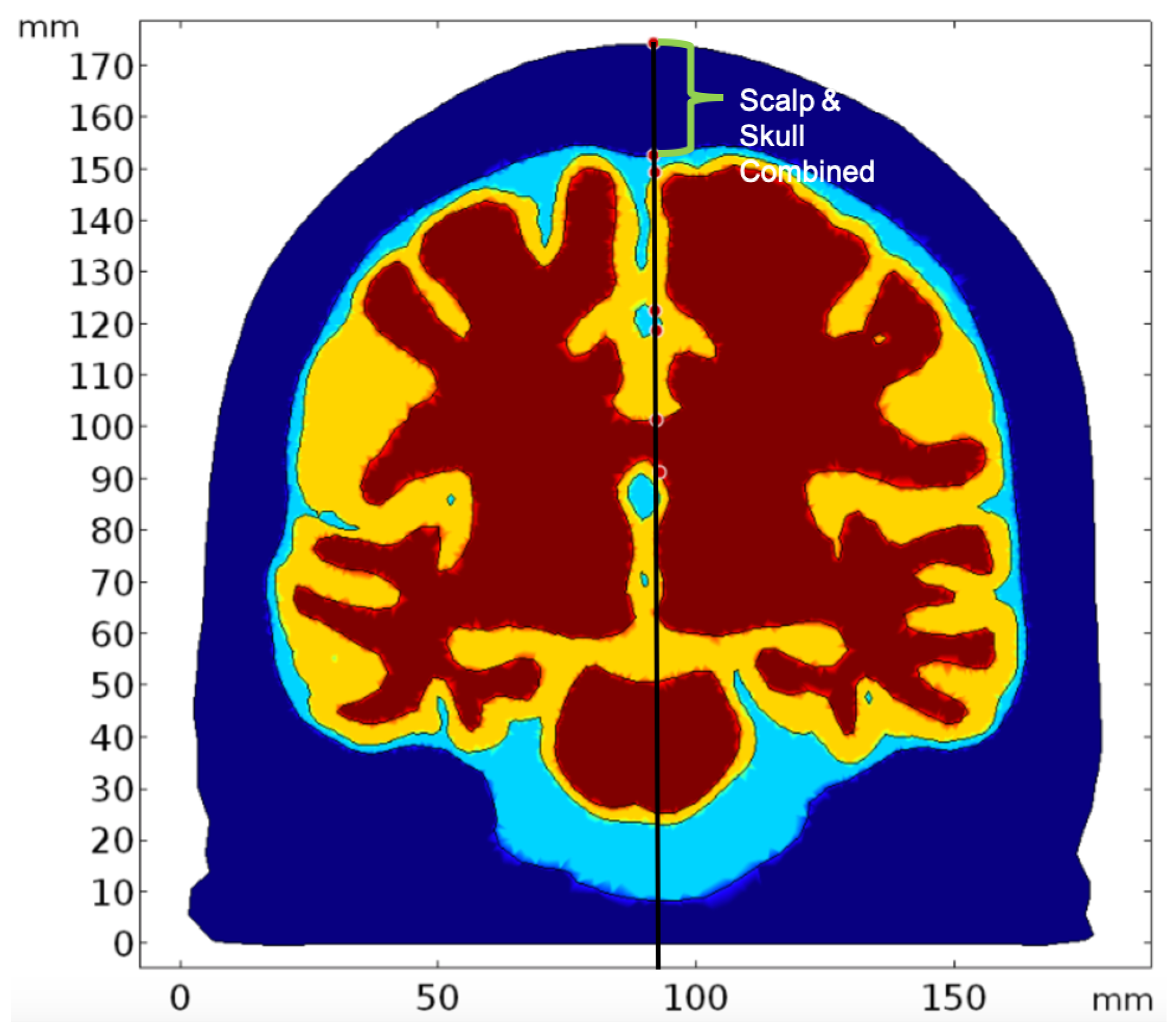 Brainsci 09 00179 g007 Brainsci 09 00179 g007
