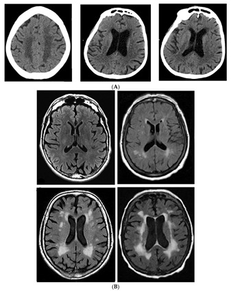 Brain Sciences Free Full Text Brain White Matter A Substrate