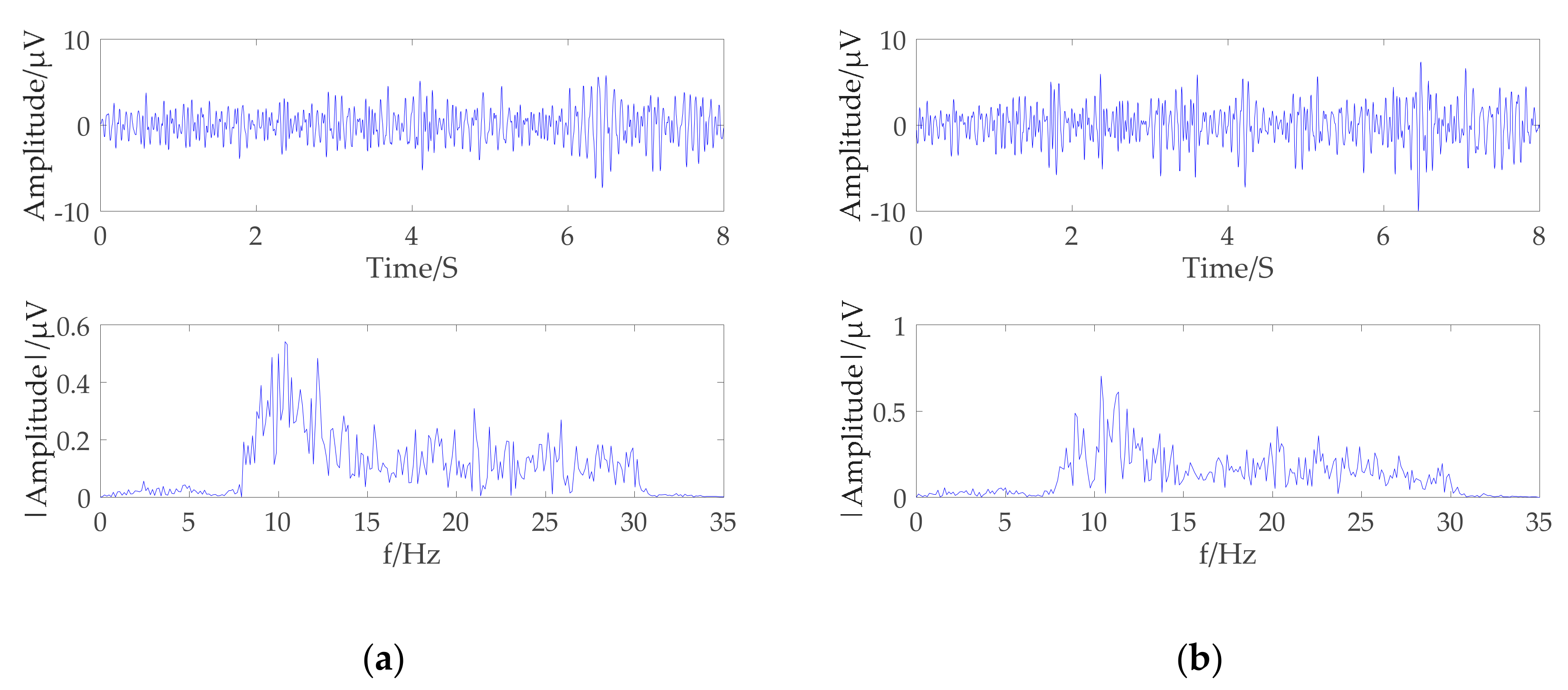 Brain Sciences Free FullText EEG Signals Feature Extraction Based