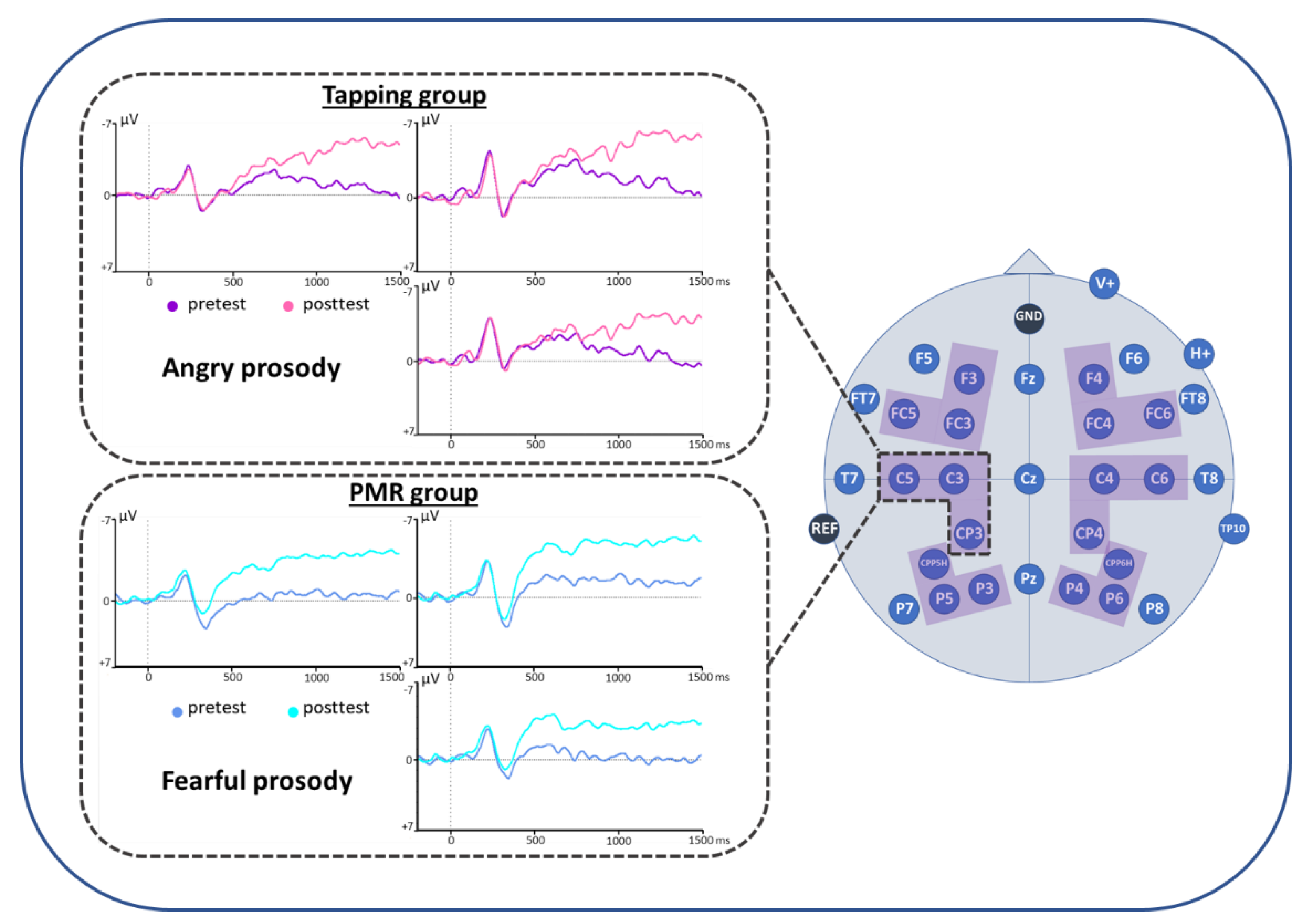 Anxiety May Alter Processing Of >> Brain Sciences Free Full Text How Therapeutic Tapping Anxiety May Alter Processing Of >> Brain Sciences Free Full Text How Therapeutic Tapping