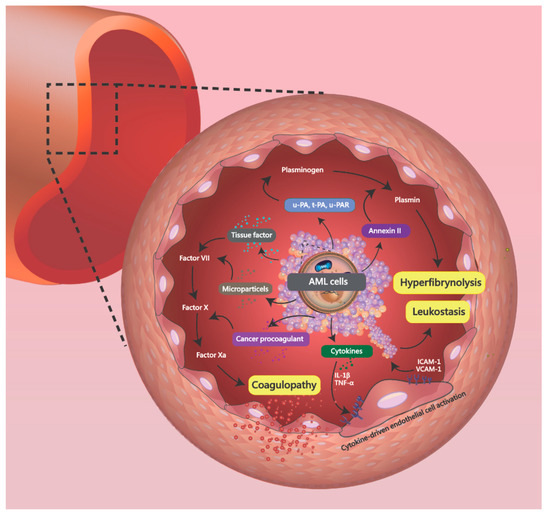 Brain Sciences Free Full Text Syncope As Initial Presentation In An Undifferentiated Type Acute Myeloid Leukemia Patient With Acute Intracranial Hemorrhage Html