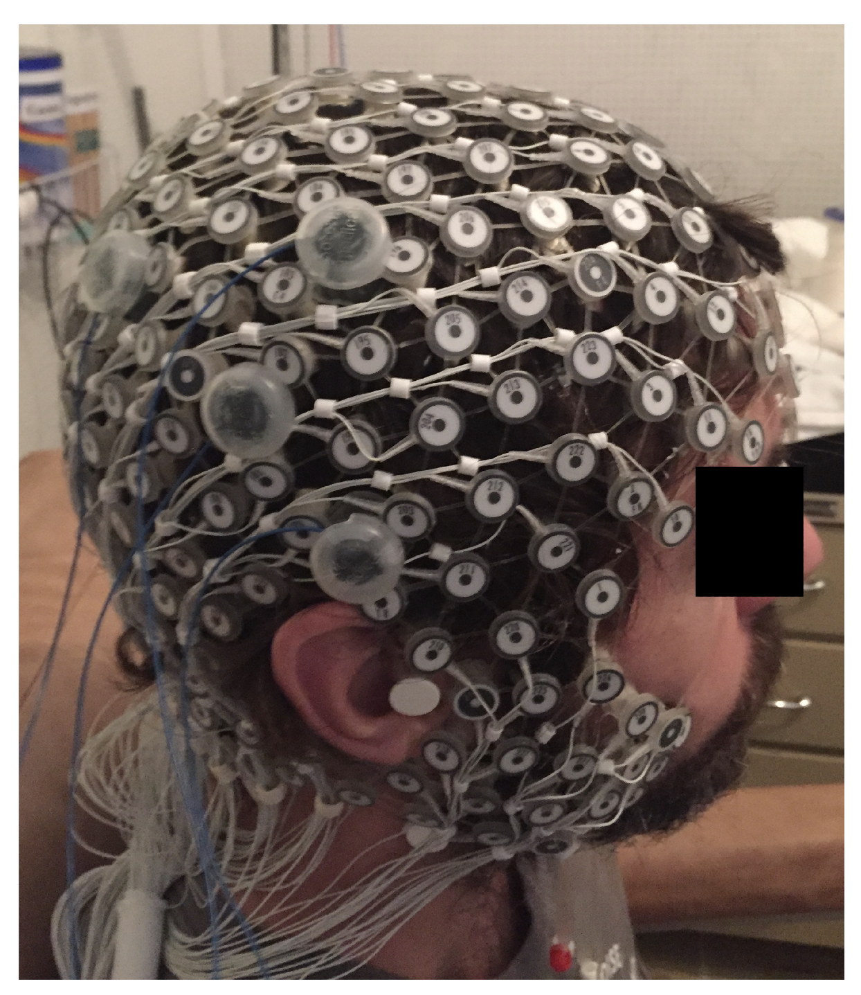 Brainsci 09 00208 g001 Brainsci 09 00208 g001