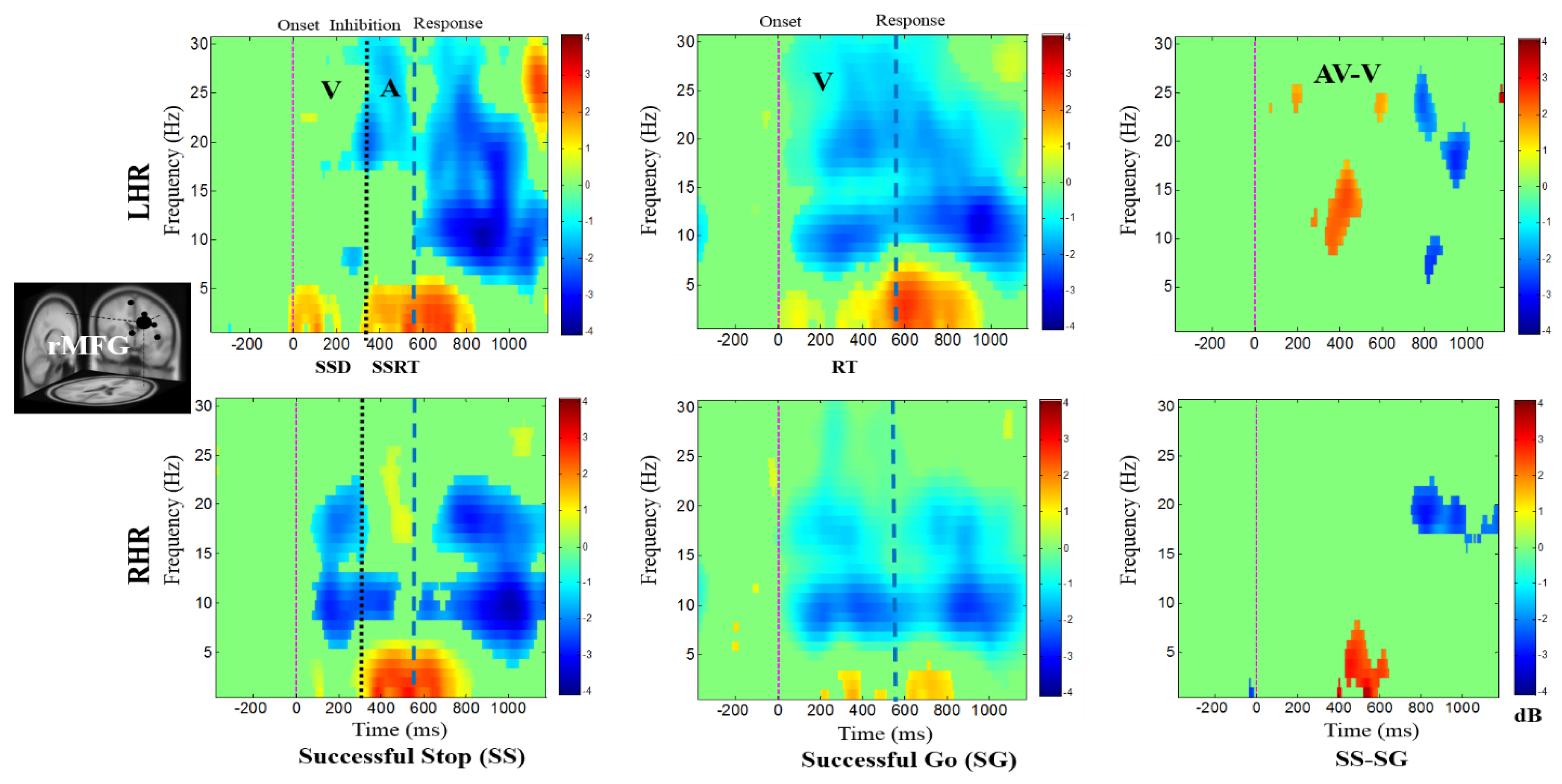 Modulation of the Visual to Auditory Human Inhibitory Brain Network: An ...