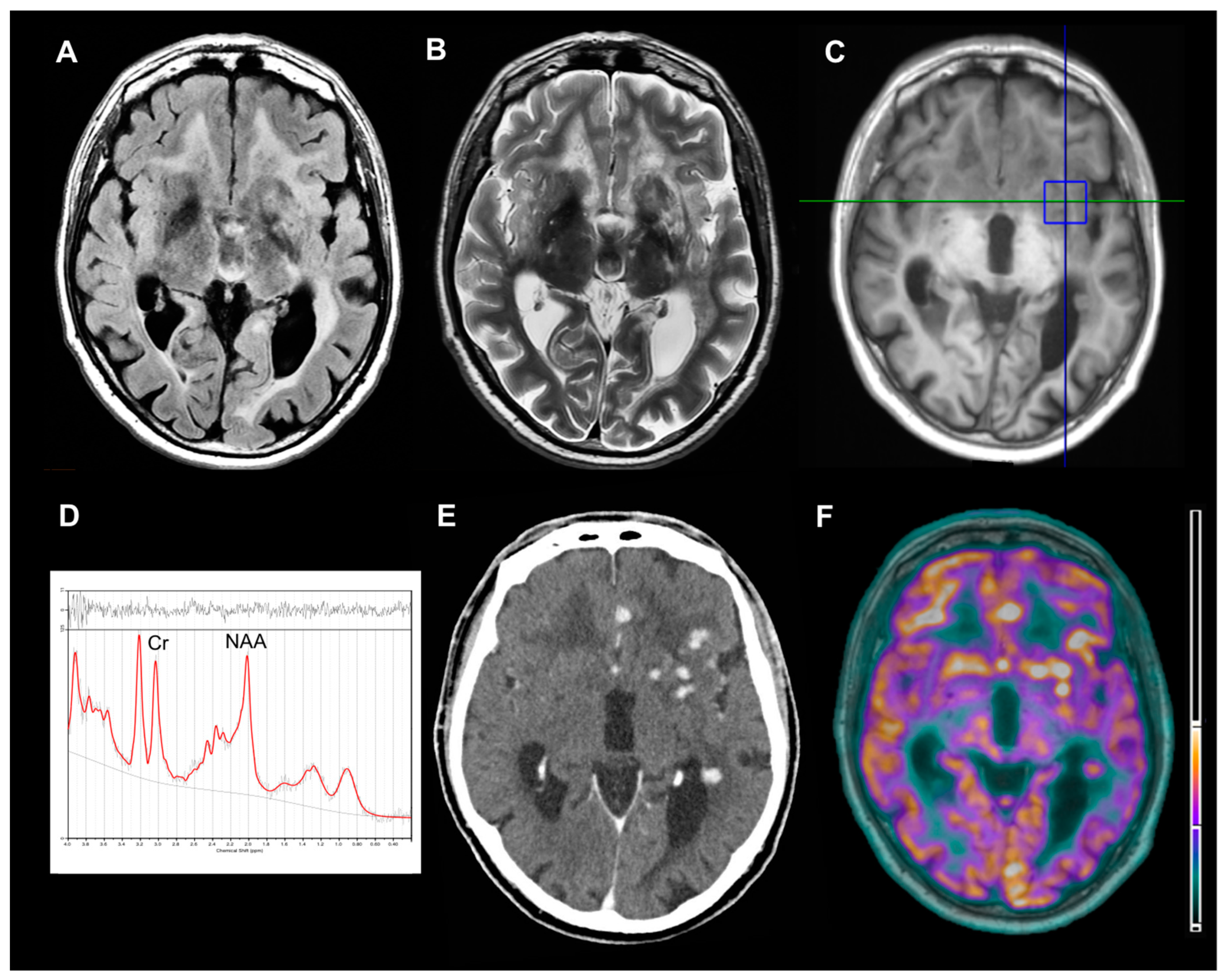 Brainsci 09 00243 g001