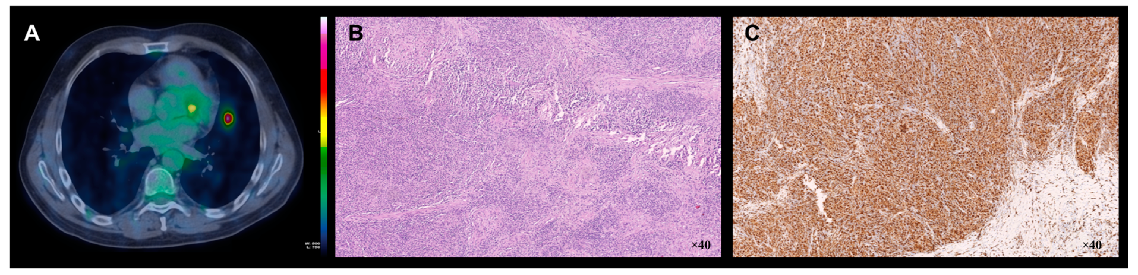 Brainsci 09 00243 g002