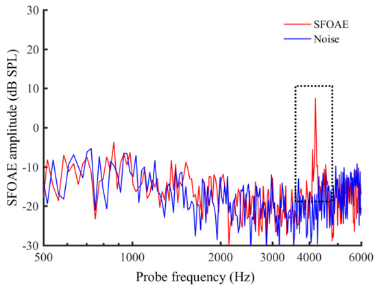 Tinnitus and normal hearing: a study on the transient otoacoustic emissions  suppression