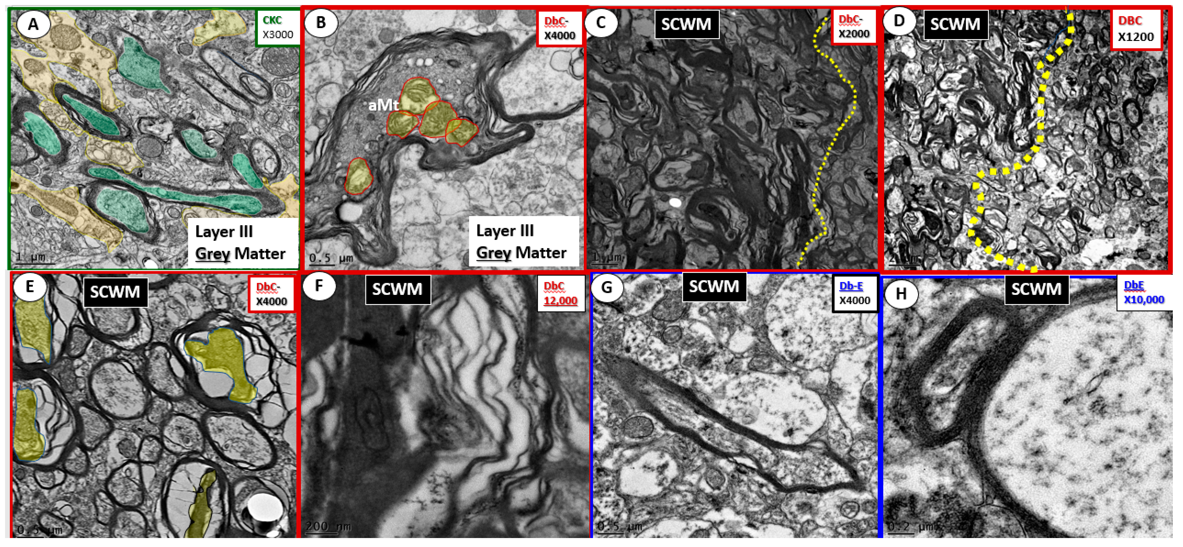Brainsci 09 00262 g018