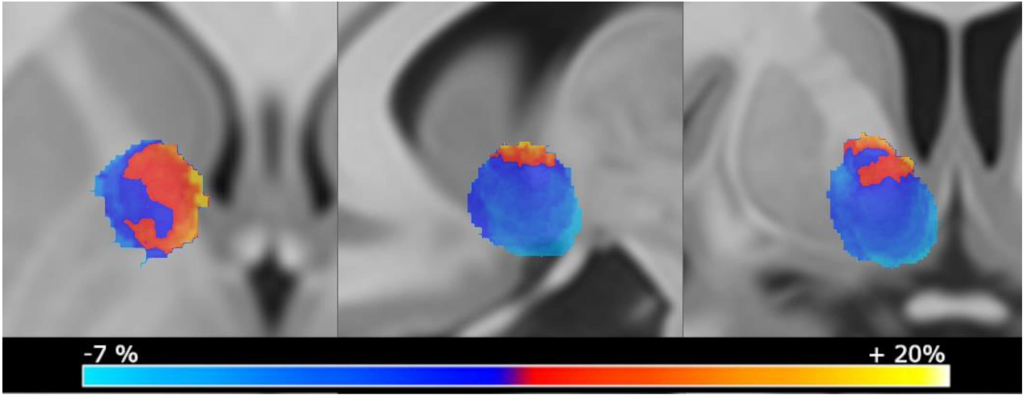 Brainsci 09 00264 g001