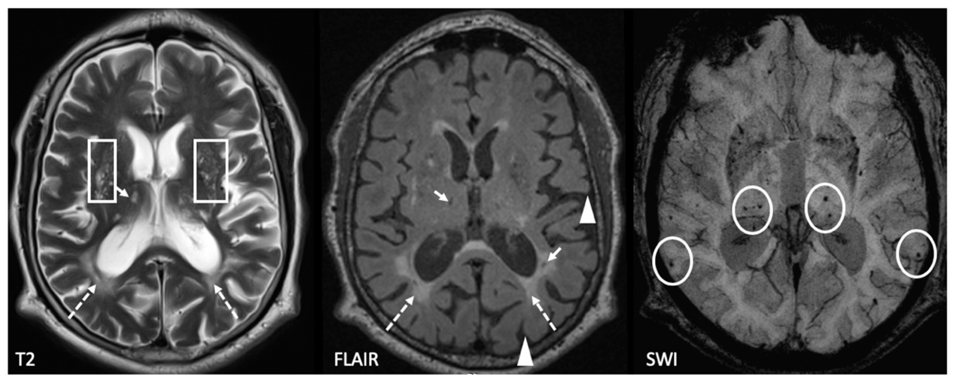 Brainsci 09 00266 g001