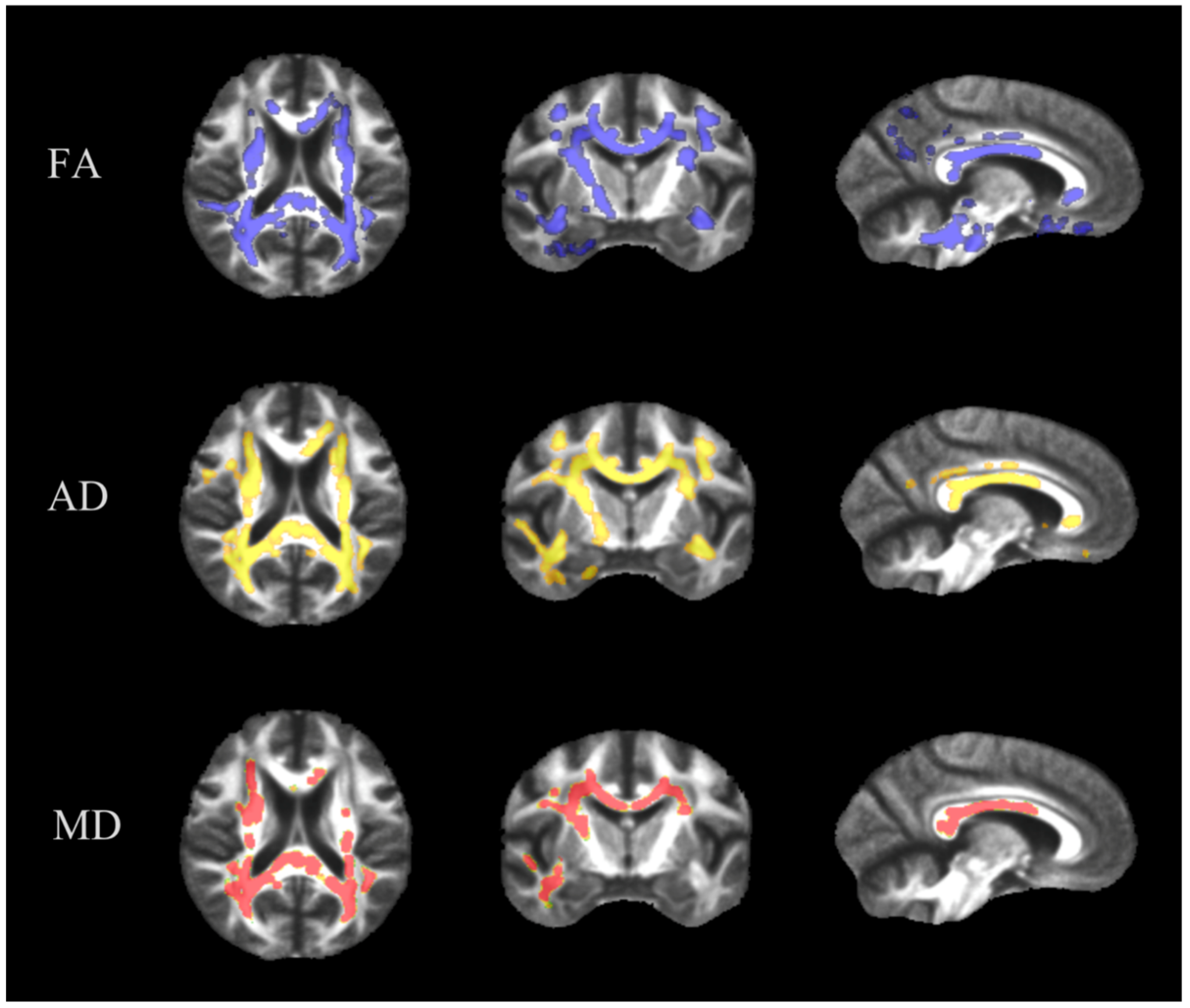 Brainsci 09 00268 g001 Brainsci 09 00268 g001