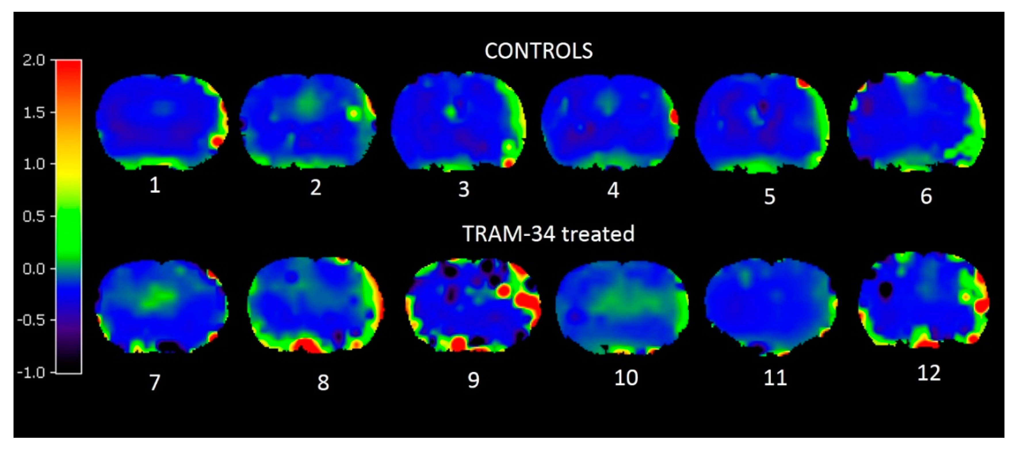 Brainsci 09 00287 g003 Brainsci 09 00287 g003
