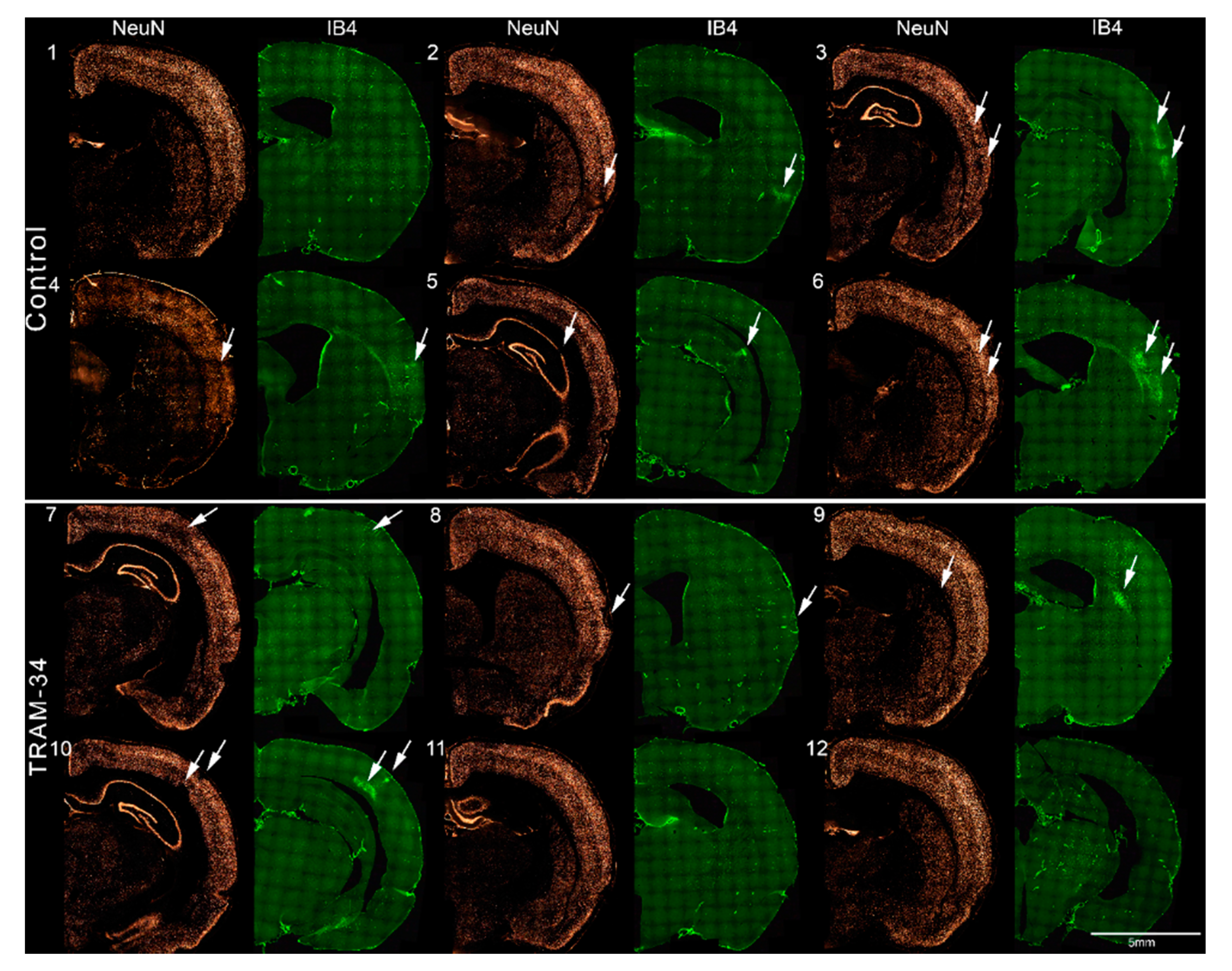 Brainsci 09 00287 g004 Brainsci 09 00287 g004