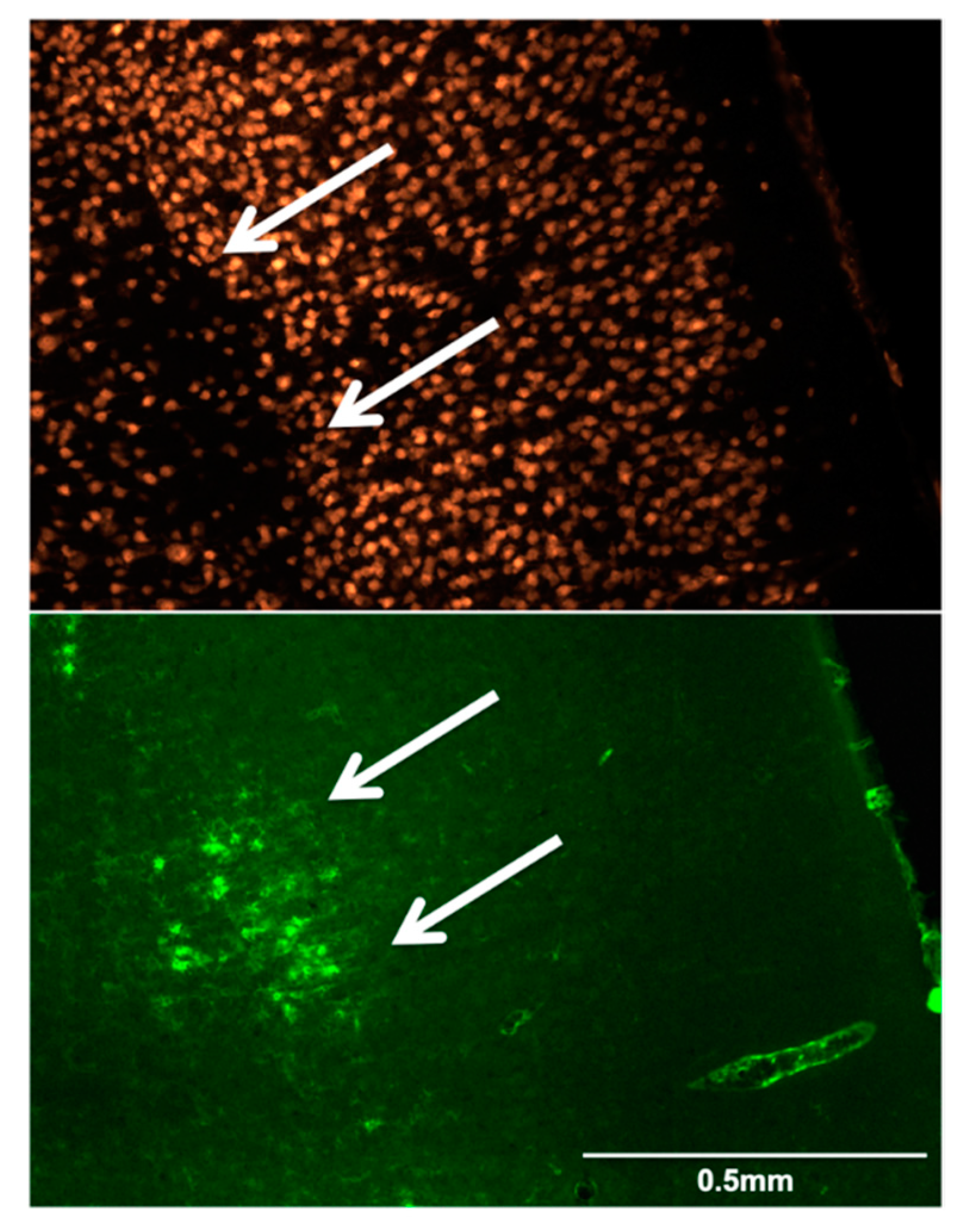 Brainsci 09 00287 g005 Brainsci 09 00287 g005