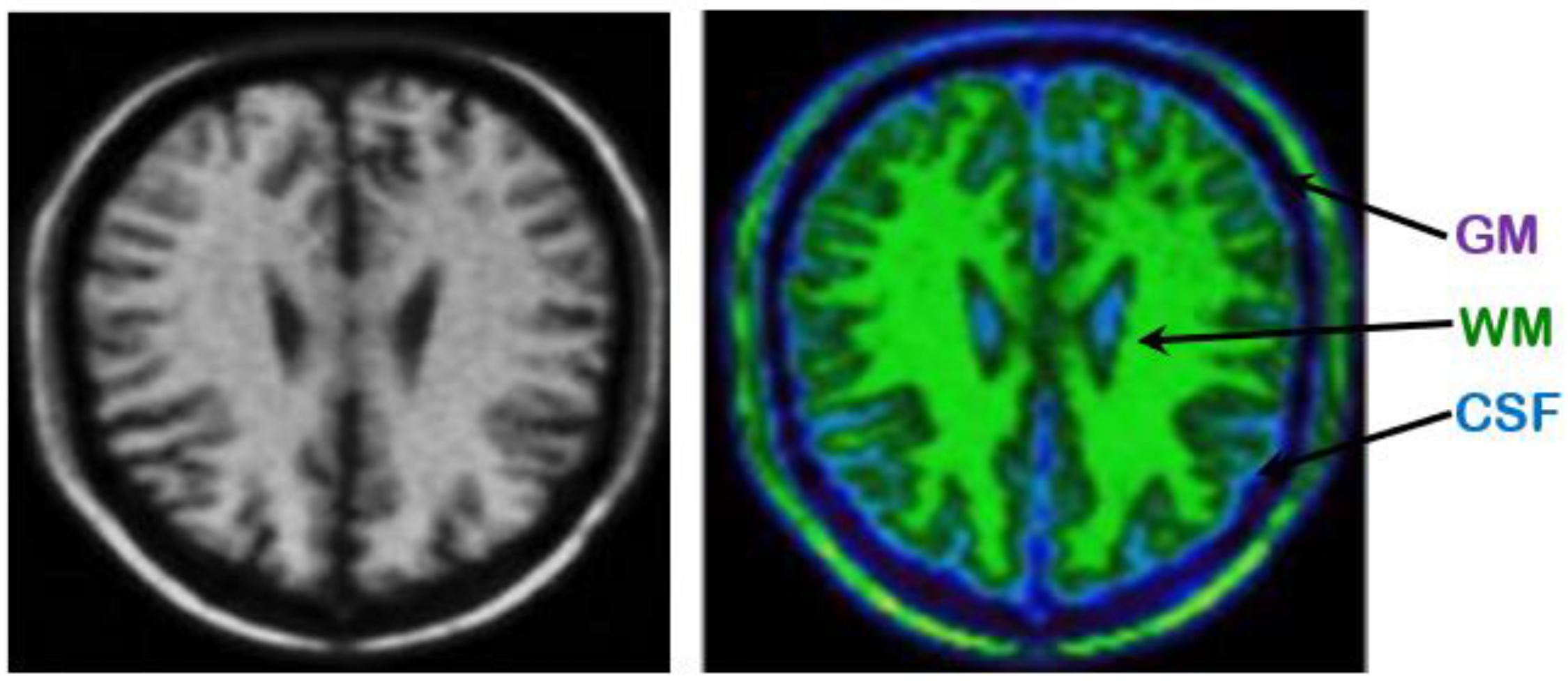 Brainsci 09 00289 g004