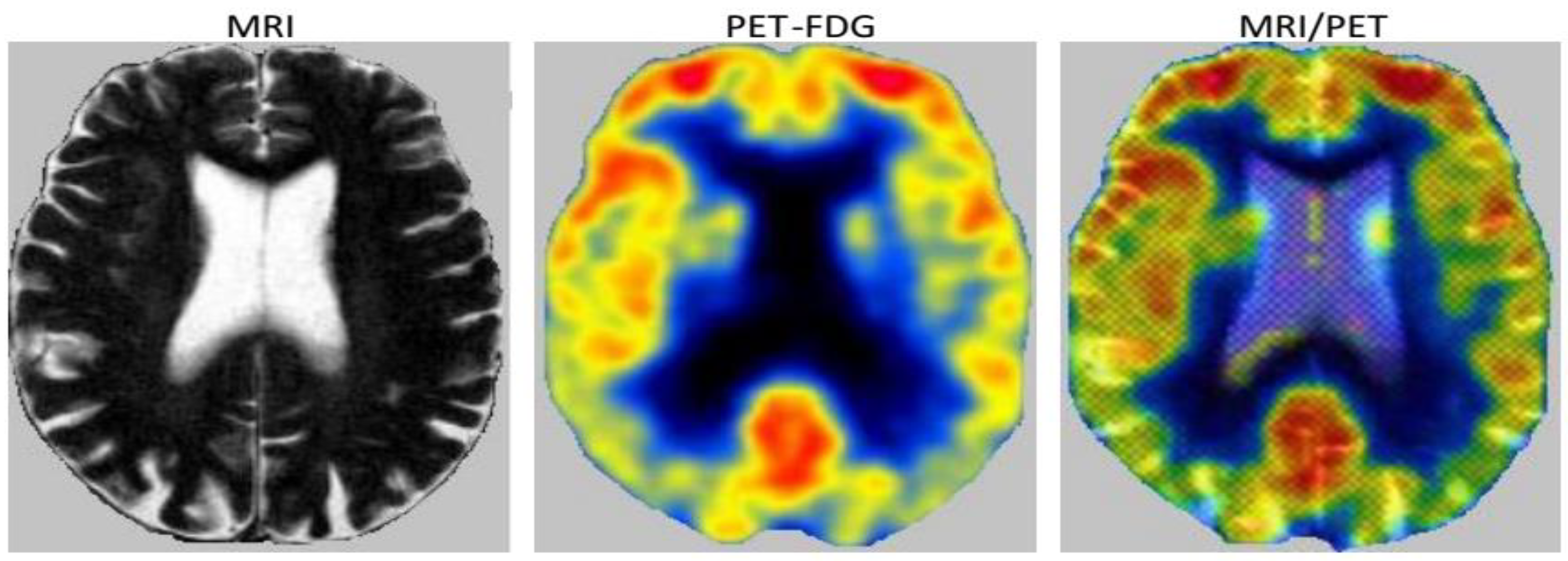 Brainsci 09 00289 g005