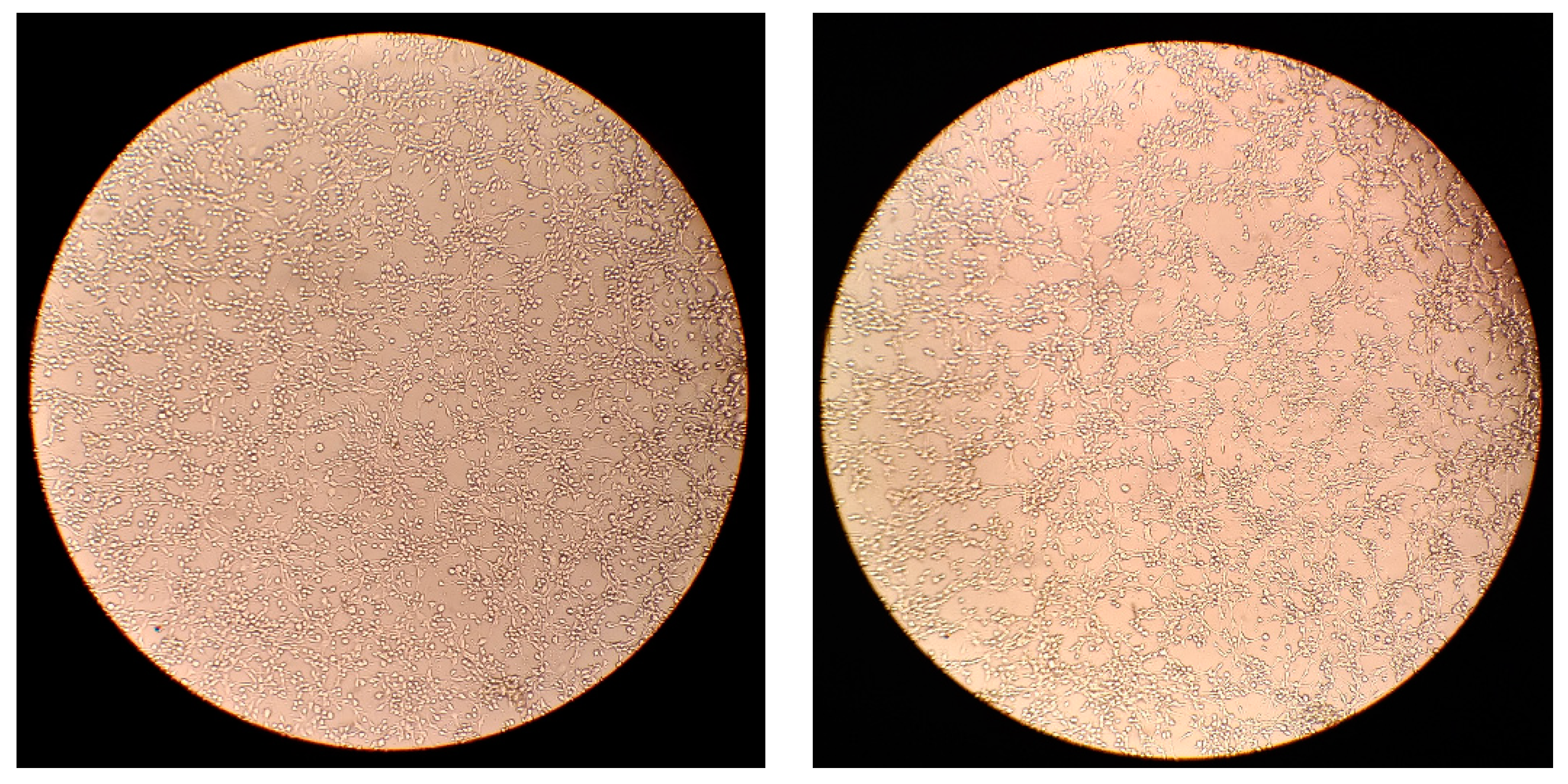 Brainsci 09 00303 g002 Brainsci 09 00303 g002