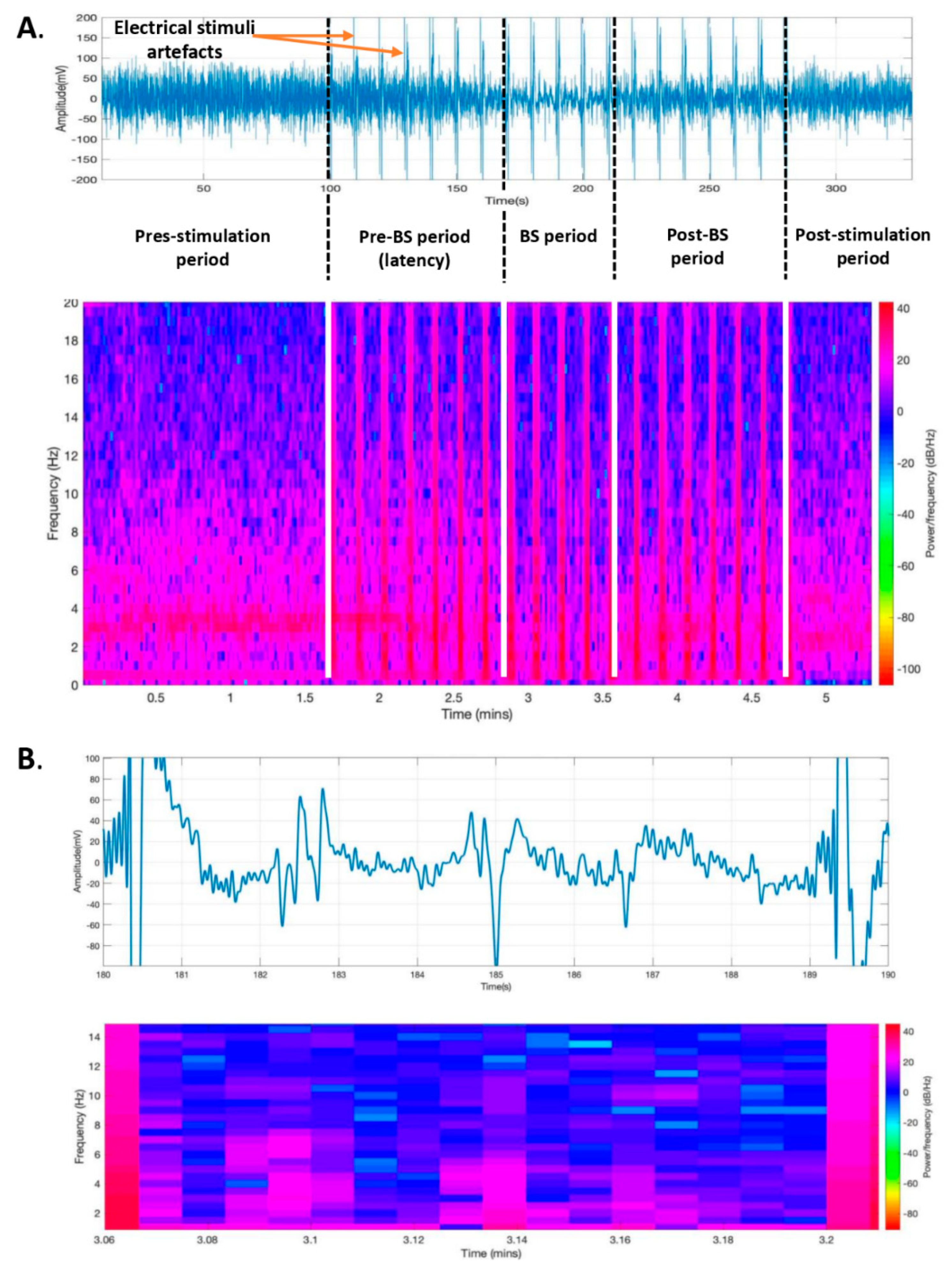 Brainsci 09 00304 g004