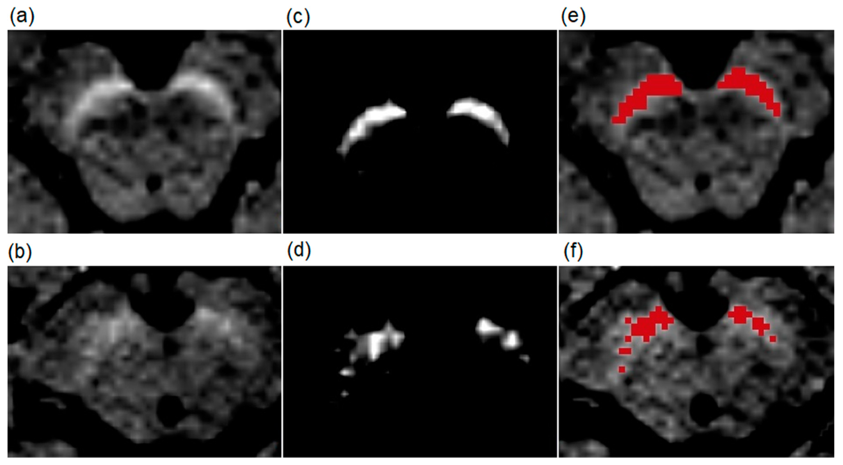 Brainsci 09 00335 g001 Brainsci 09 00335 g001